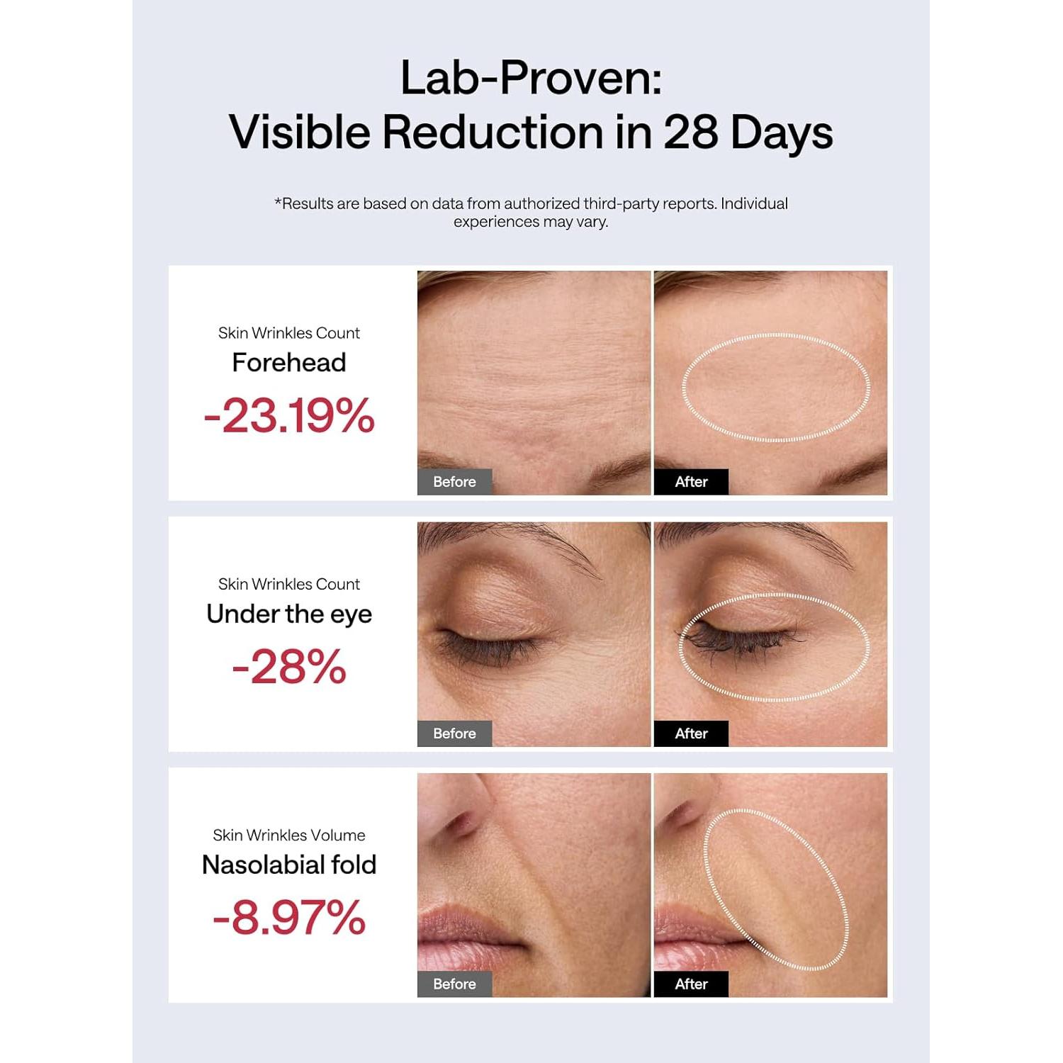 Dispositivo Facial JMOON M30U - Tonificación y Luz Roja