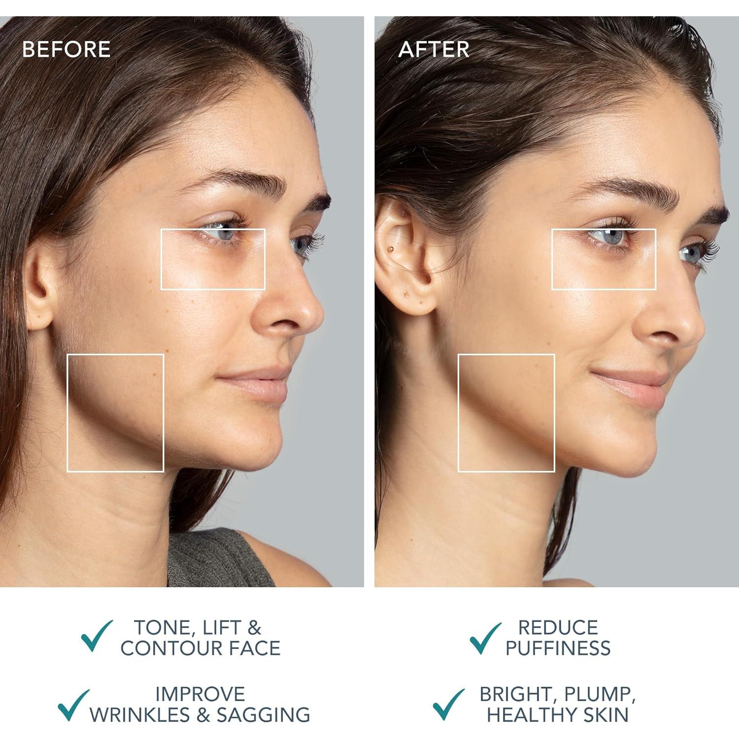 Dispositivo Facial Microcorriente FOREO Bear 2 - Tonificación y Lifting