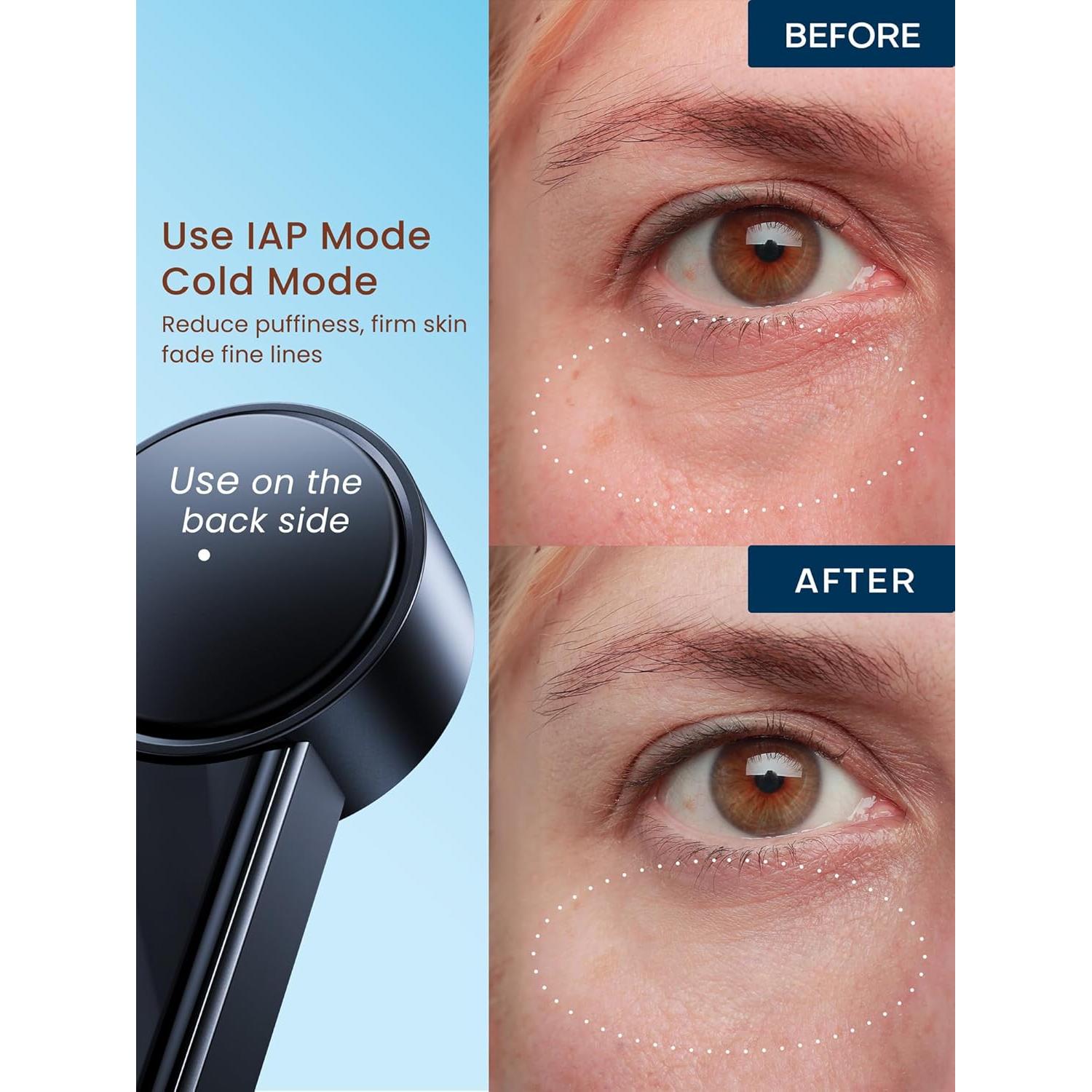 Dispositivo de Tensado de Piel RF NL04 YINGAO - 6 Modos Inteligentes