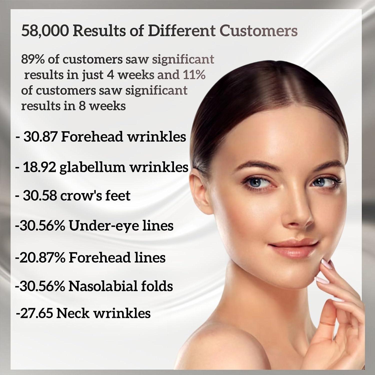 Dispositivo Facial Reafirmante WarmDerm EP-300 5-en-1 2025