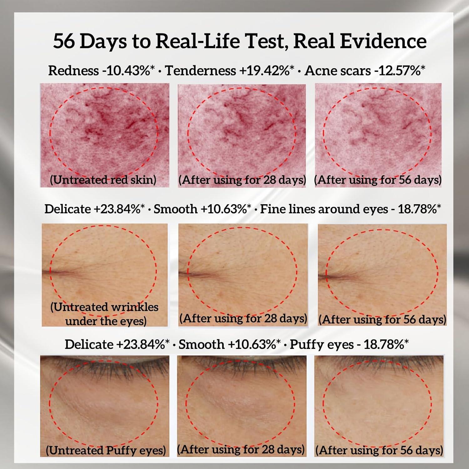 Dispositivo Facial Reafirmante WarmDerm EP-300 5-en-1 2025