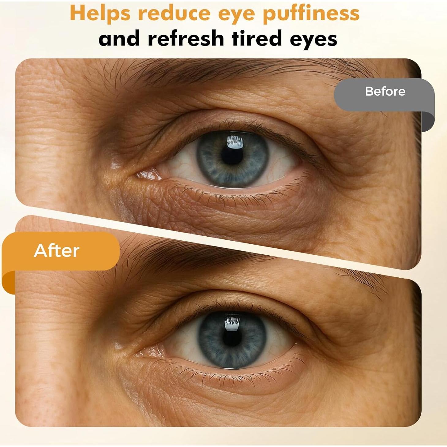 Varita Desinflamante REDLOOK Plata - Rodillo Facial Frío y Caliente