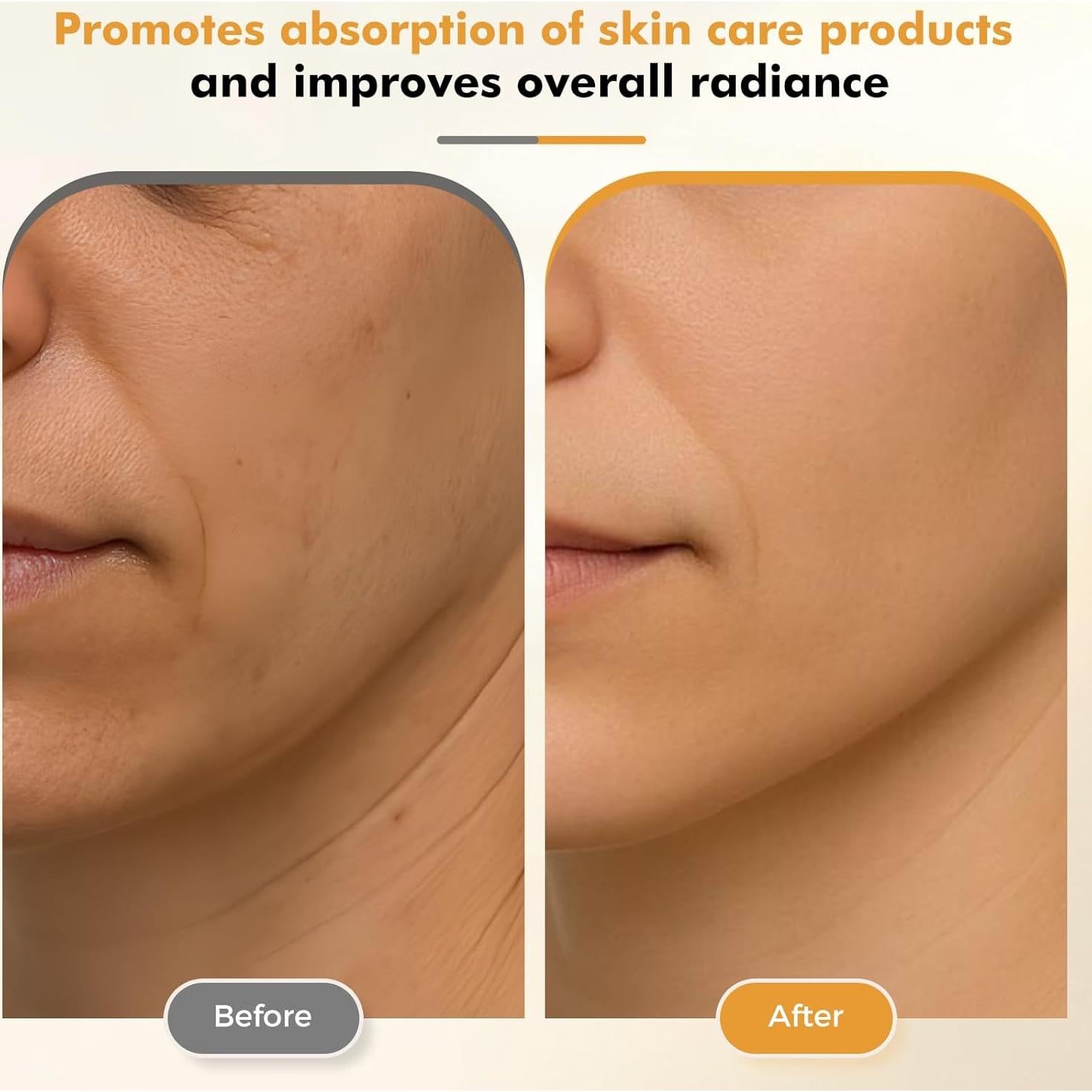 Varita Desinflamante REDLOOK Plata - Rodillo Facial Frío y Caliente