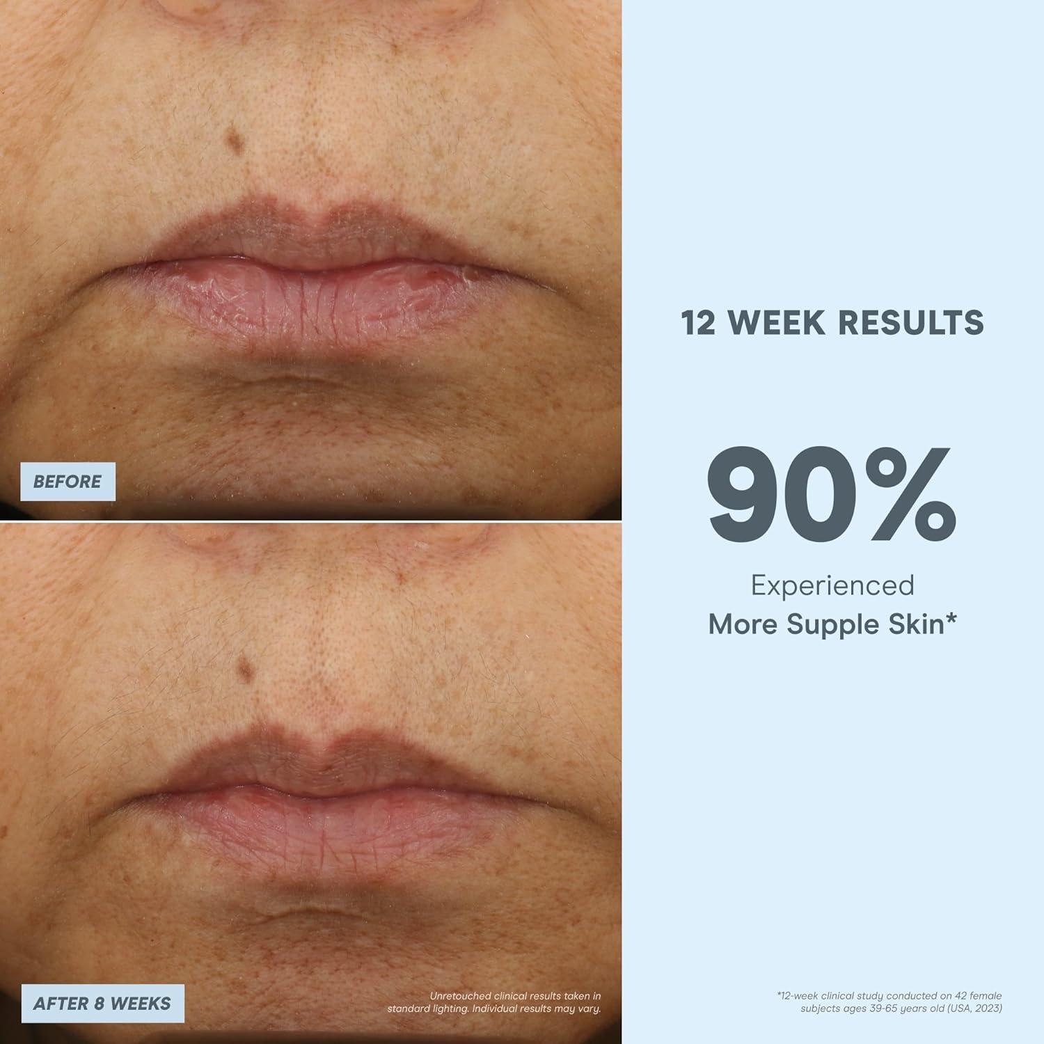 Suero Facial Peptídico NuFACE 29.57 ml - Afirmante y Hidratante