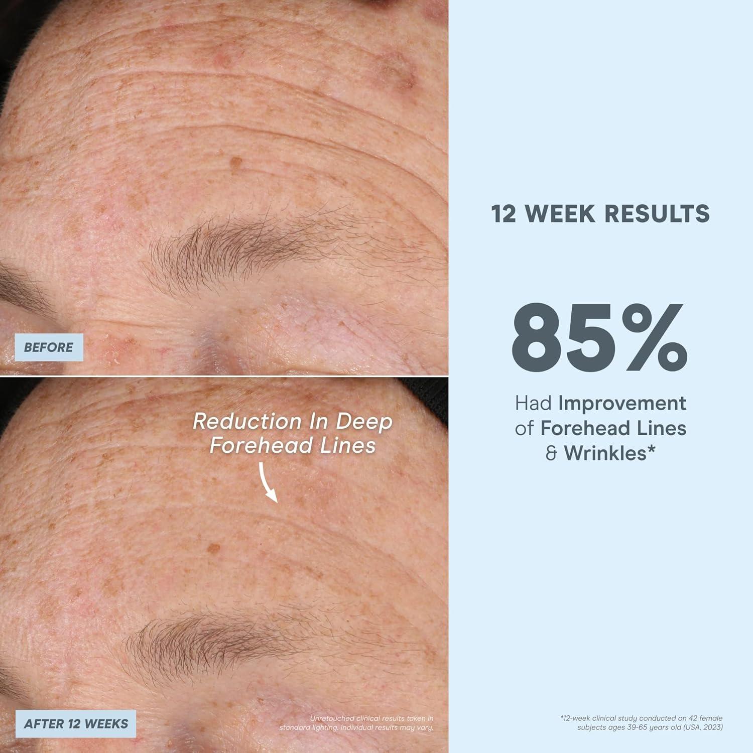 Suero Facial Peptídico NuFACE 29.57 ml - Afirmante y Hidratante