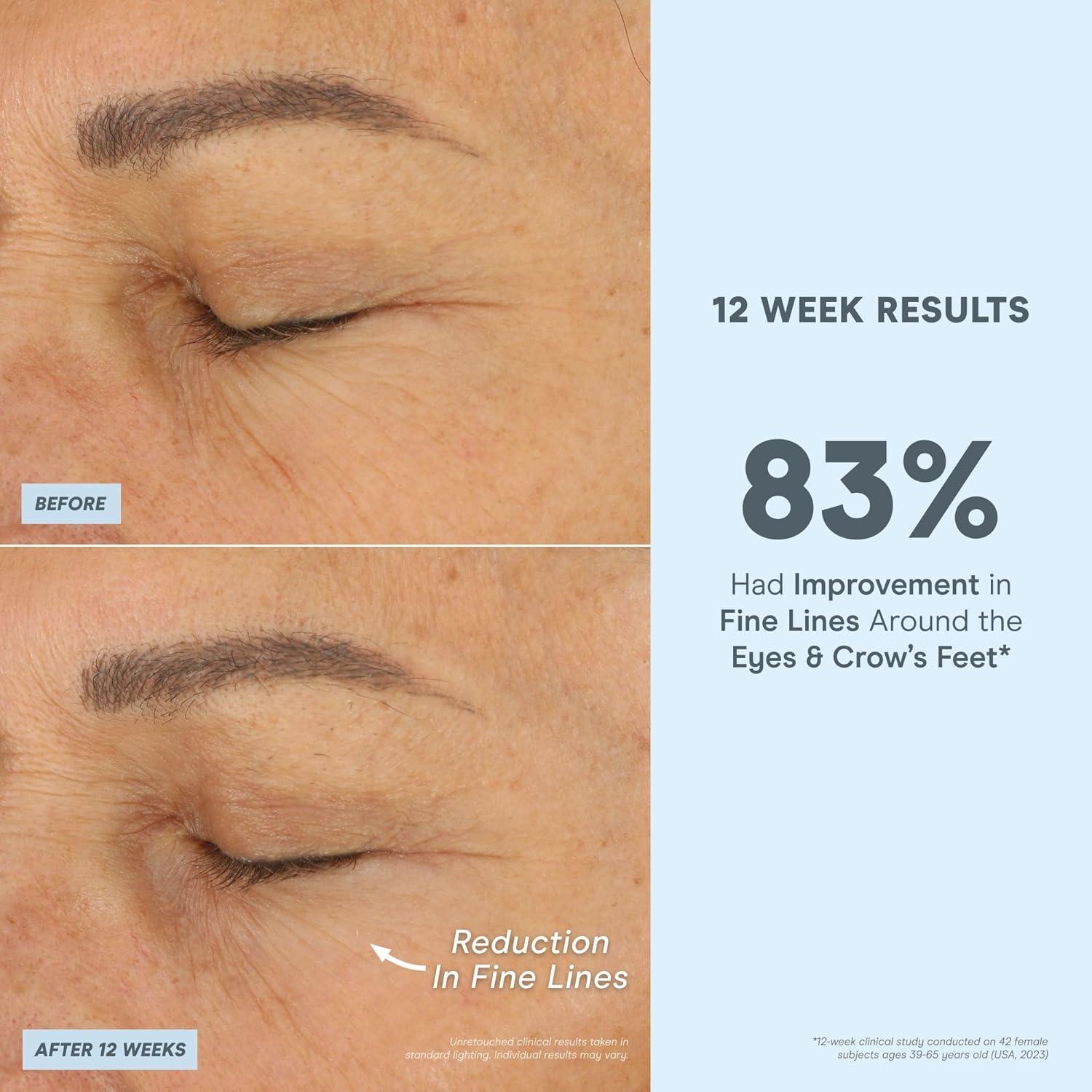 Suero Facial Peptídico NuFACE 29.57 ml - Afirmante y Hidratante