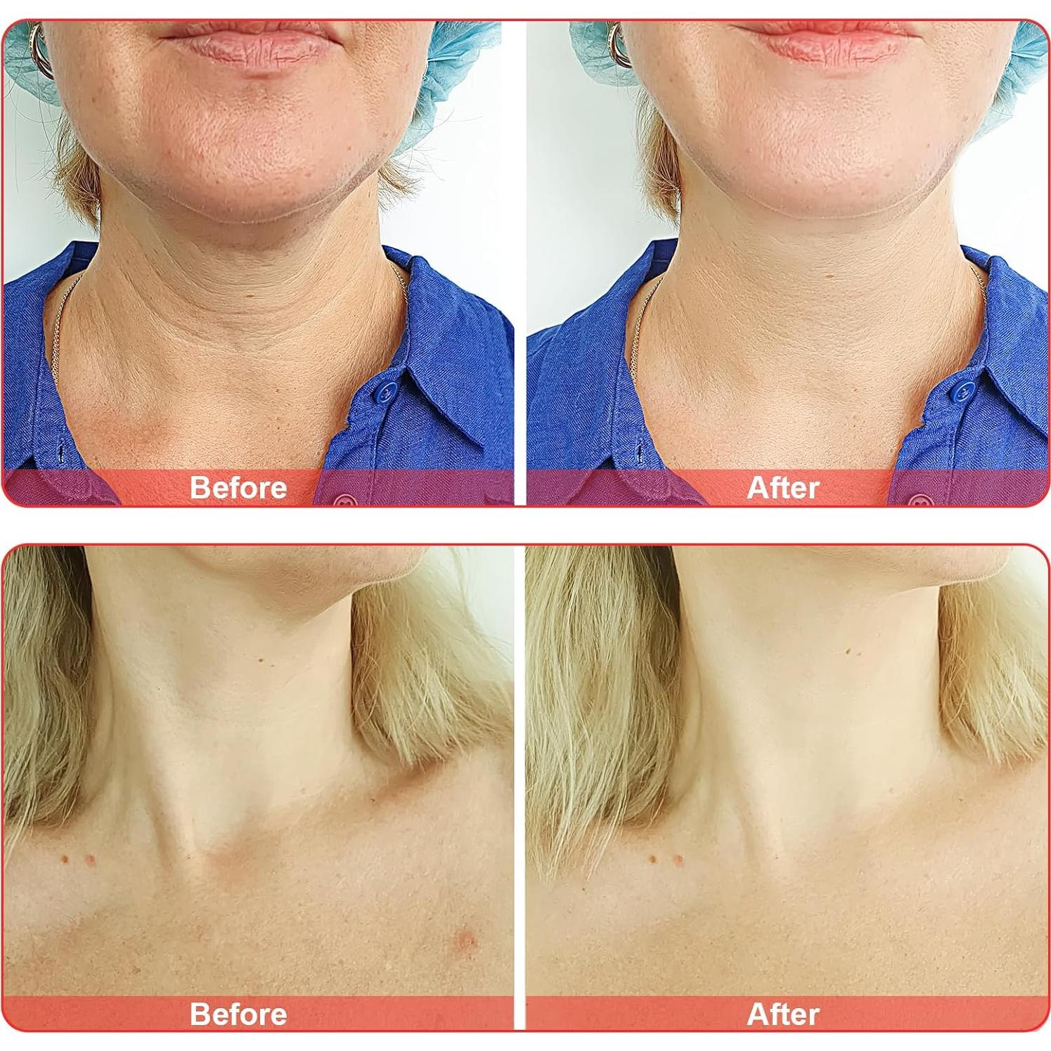 Varita de Electrodos de Vidrio Elitzia ETHB01 Naranja Forma Y