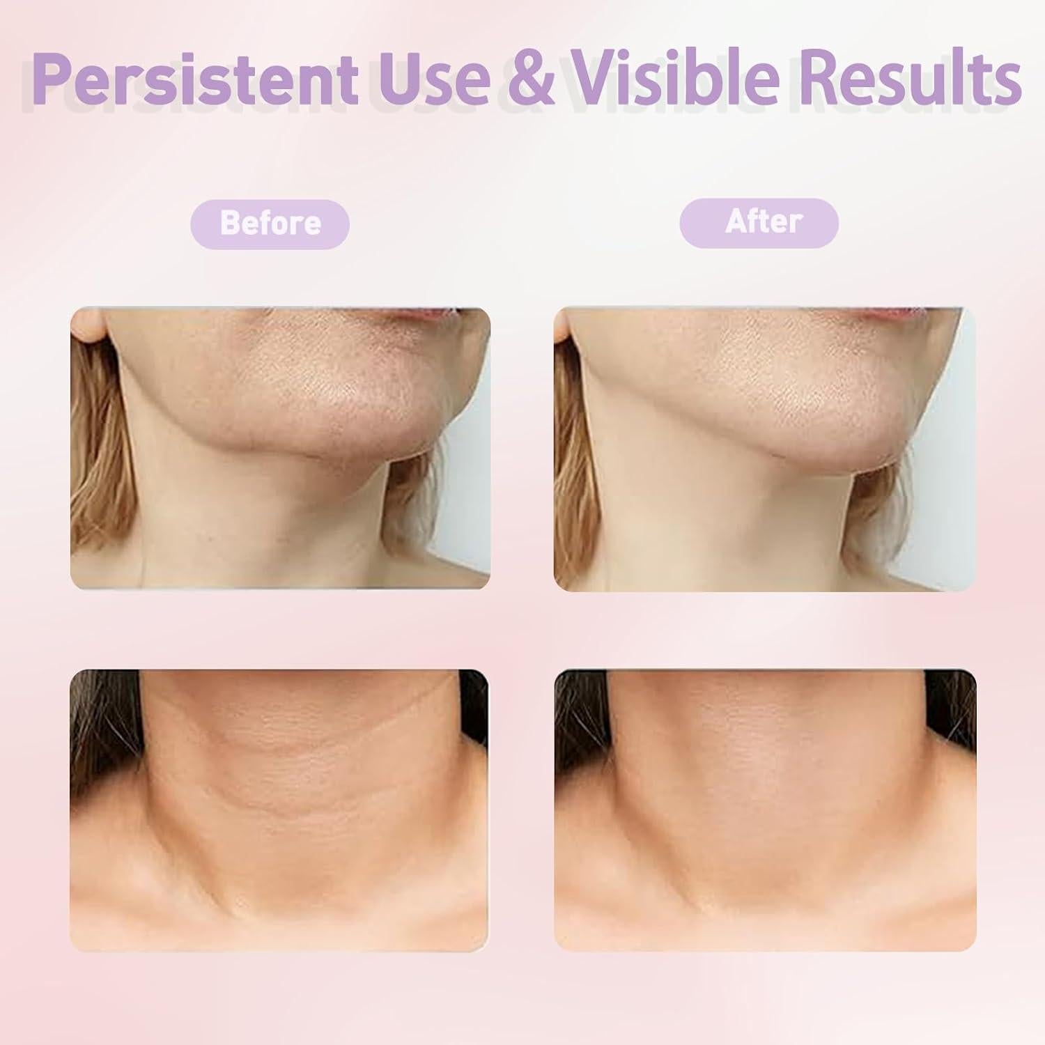 Masajeador Facial SavFinto 7 Colores LED Ergonomico 45°C