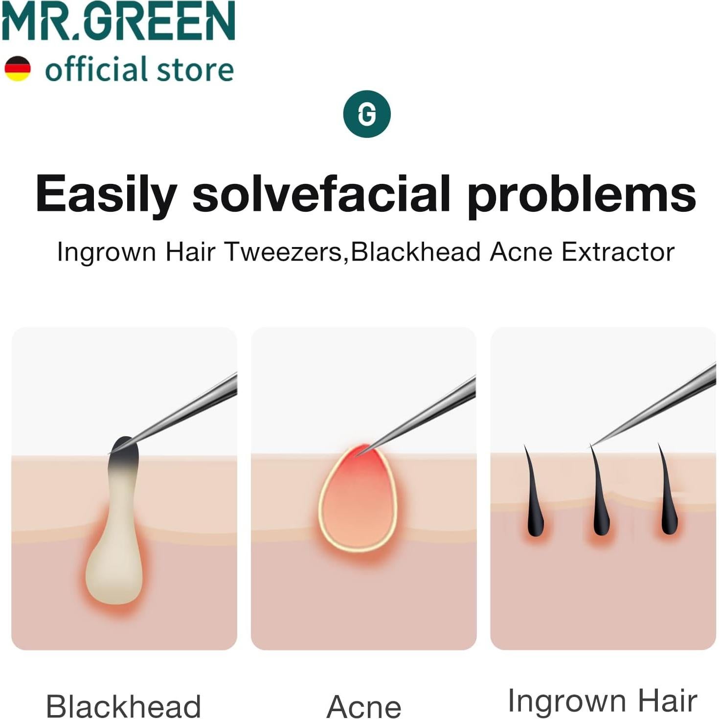 Pinzas de Pelo Encarnado MR.GREEN Punta de Aguja Ergonómicas