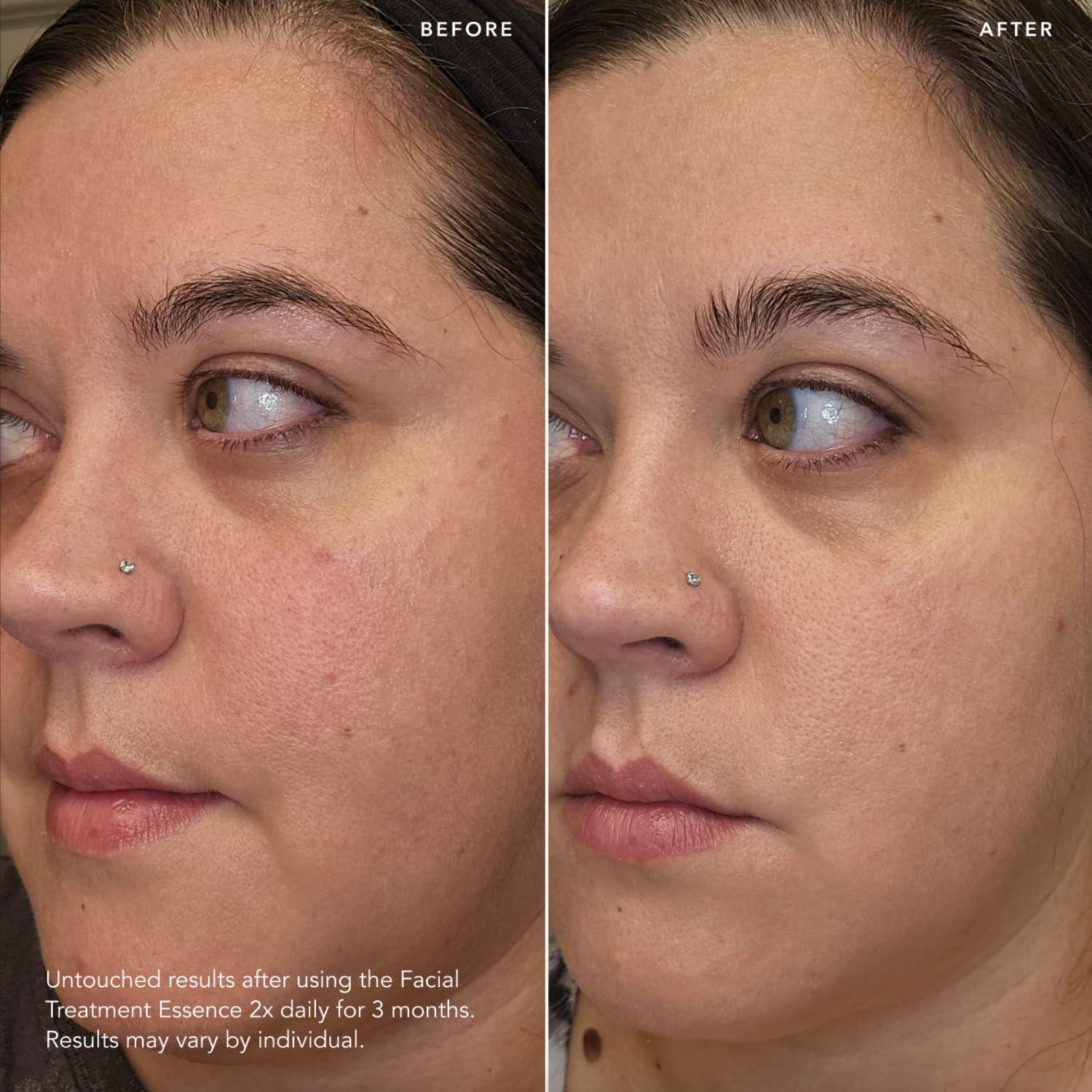 SK-II Esencia Facial Antienvejecimiento 227 ml - Reduce Arrugas