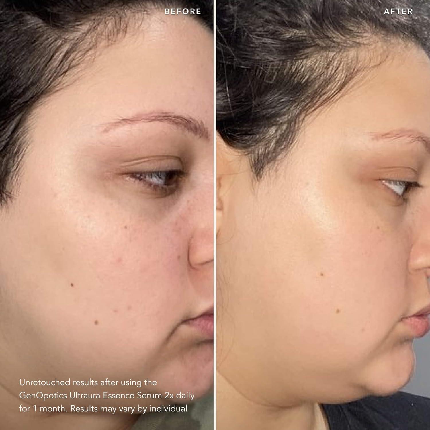 SK-II Dúo Radiancia y Firmeza - Suero GenOptics 50ml y Hidratante 80ml