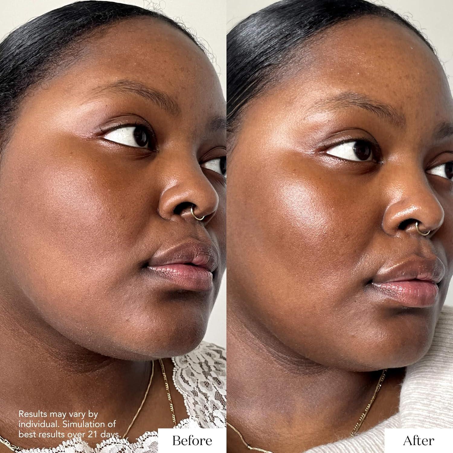 SK-II Dúo Radiancia y Firmeza - Suero GenOptics 50ml y Hidratante 80ml