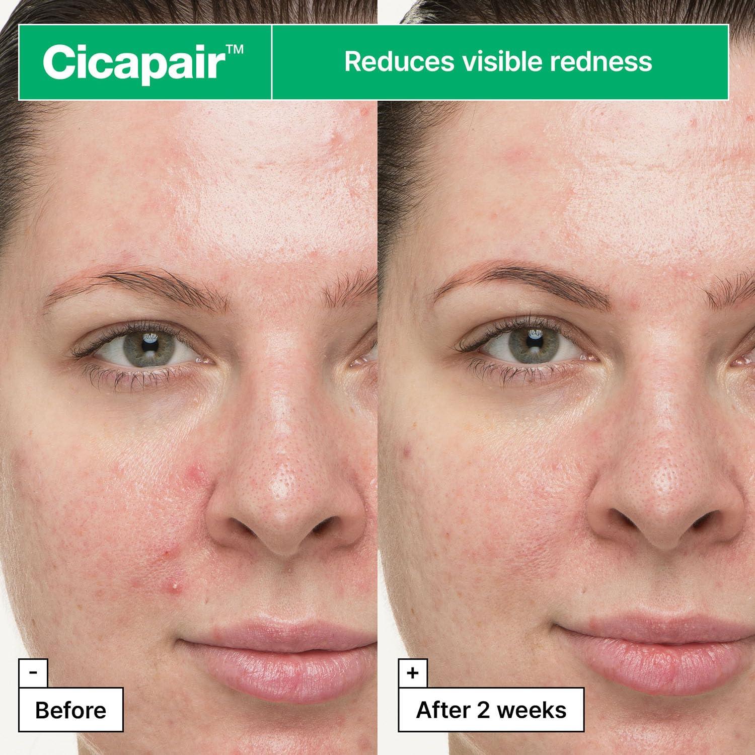 Crema en Gel Calmante Dr.Jart+ Cicapair 30 ml para Piel Irritada