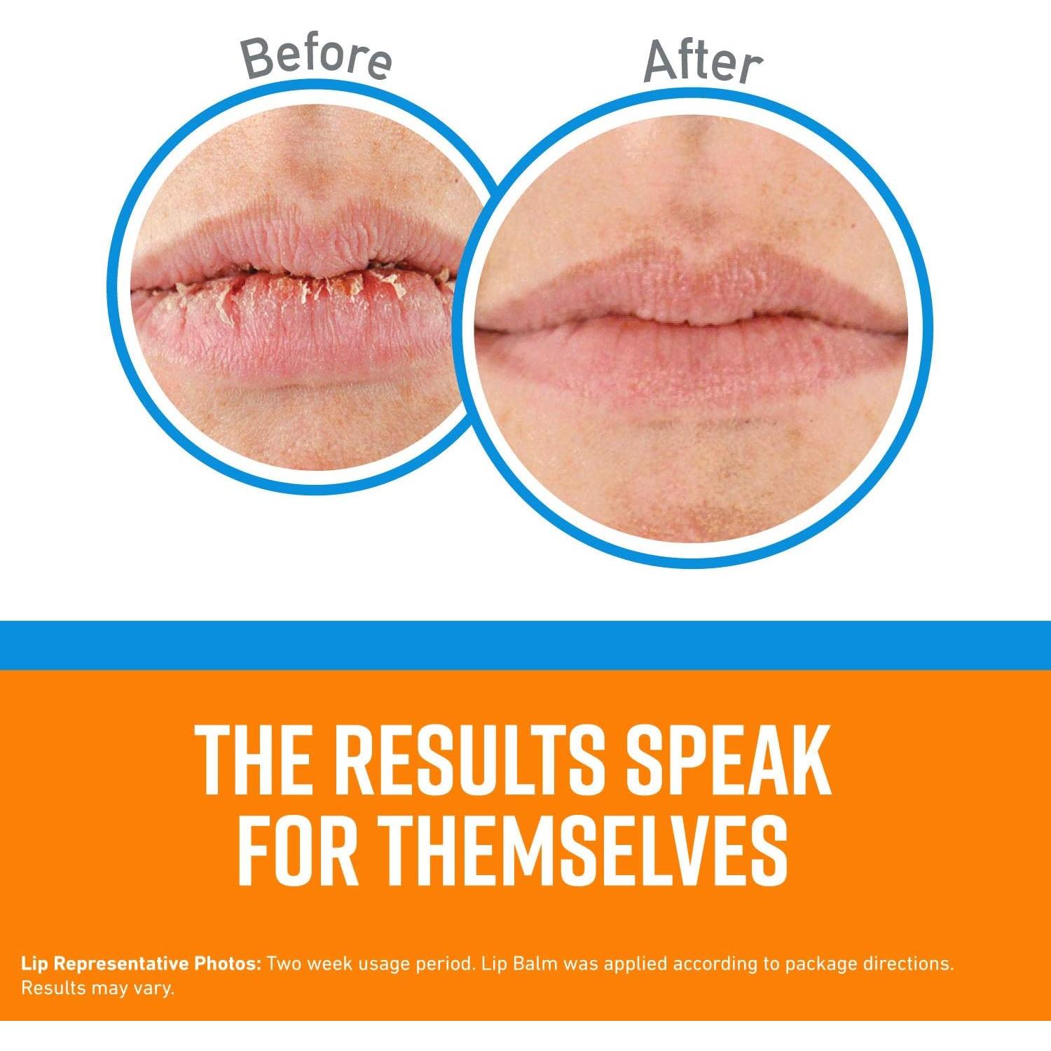 Bálsamo Labial O'Keeffe's Lip Repair Alivio Refrescante 4 Stick