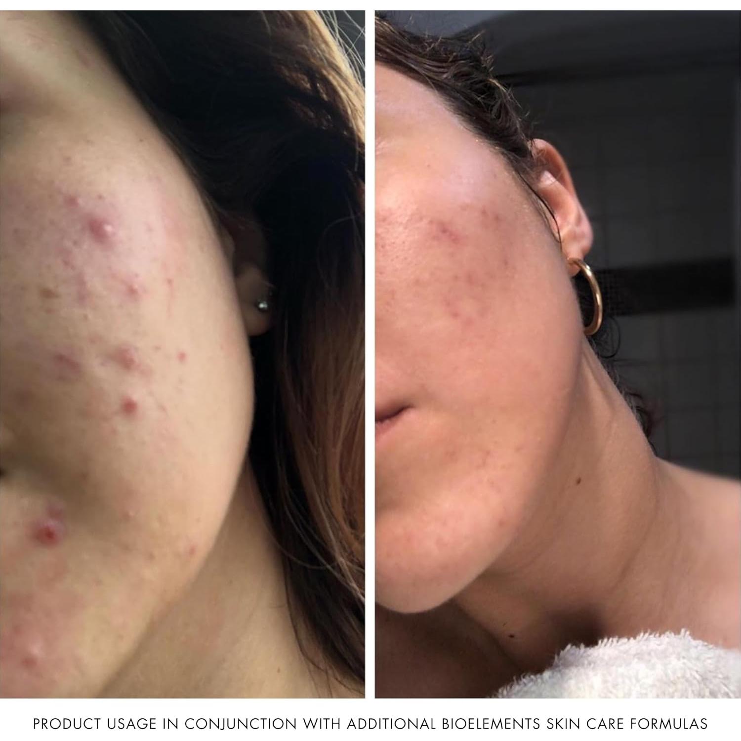 Limpiador Hidratante Bioelements 74.57 ml - Piel Seca