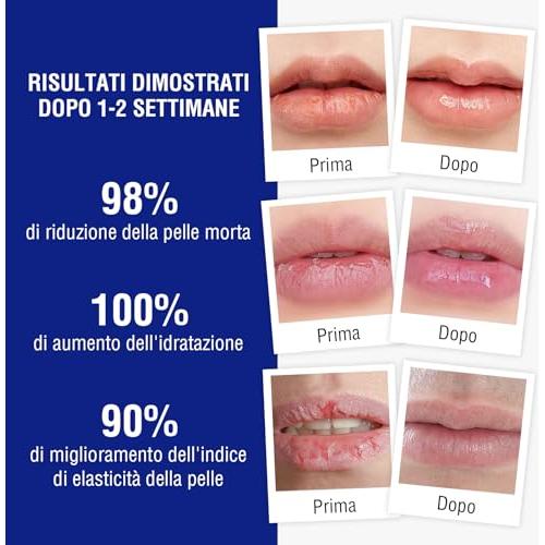 Bálsamo Labial Medicado OUKEYA 100% Natural 24H Hidratante