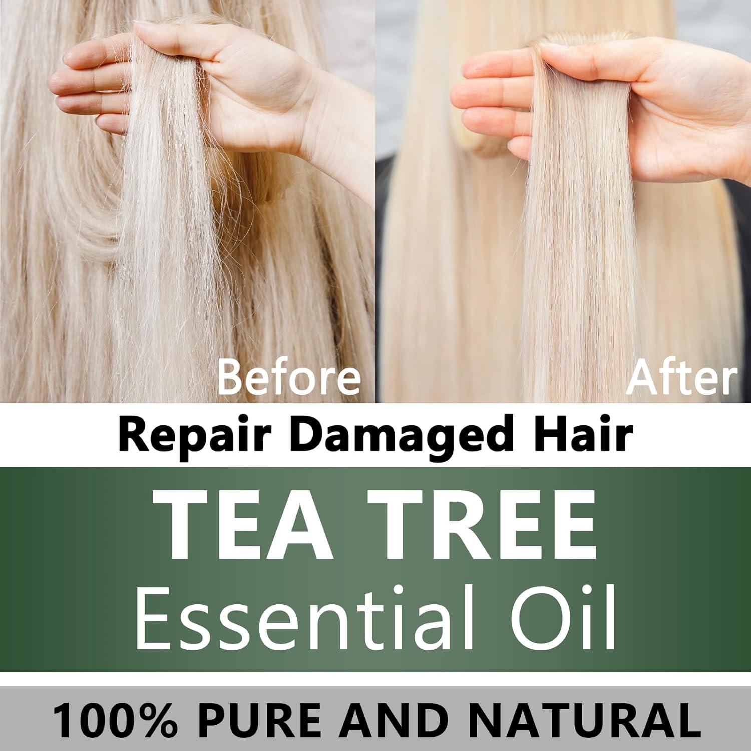 Aceite Esencial de Árbol de Té 100% Puro 97.6 ml para Aromaterapia