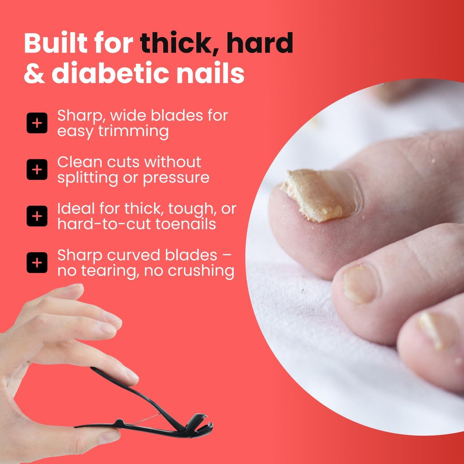 Cortaúñas Angulados KLIPP para Uñas Gruesas y Enterradas