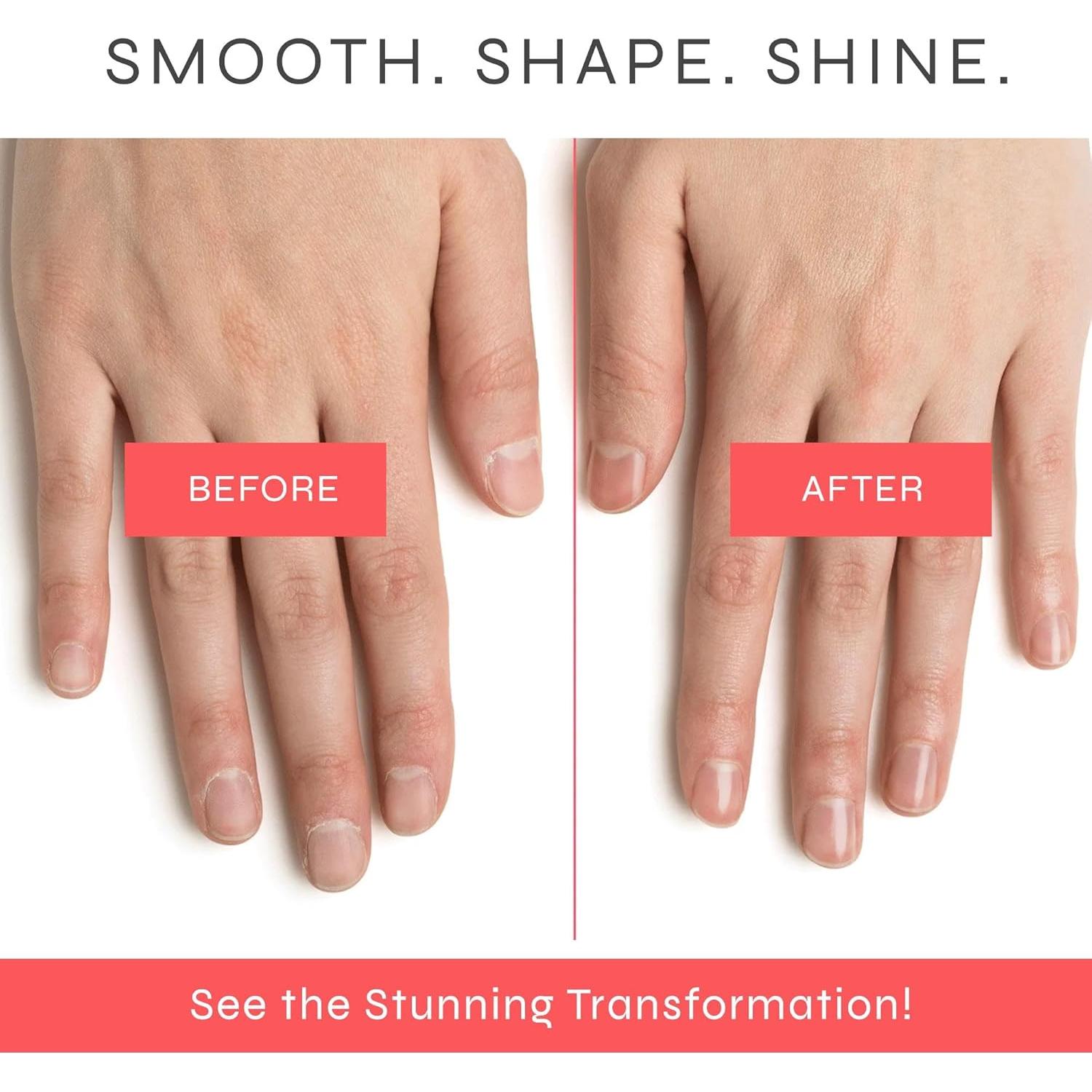 Set de Manicura Sin Esmalte Dr. Dana - Cuidado de Uñas Saludables