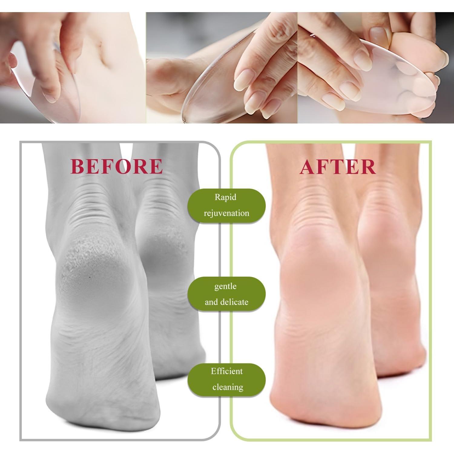 Lima de Vidrio TORMEN 2 Pcs para Pies y Uñas - Exfoliación Suave