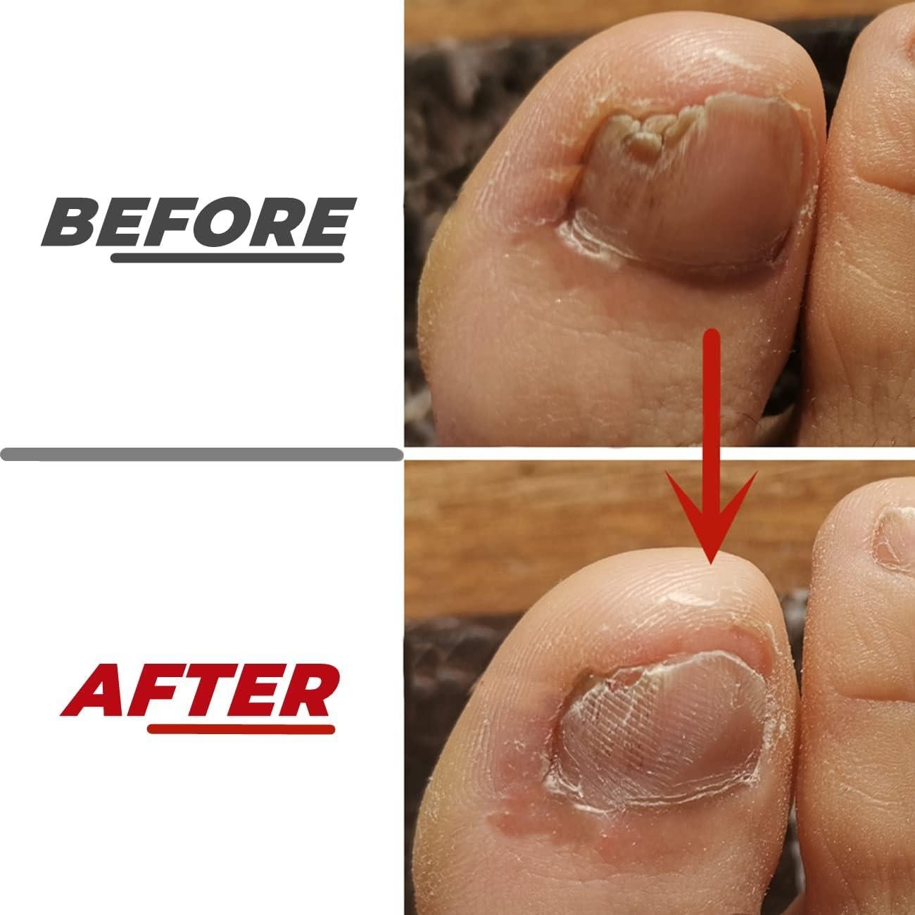 Lima de Uñas de Pies IDOU 2 Piezas Acero Inoxidable 17.78 cm