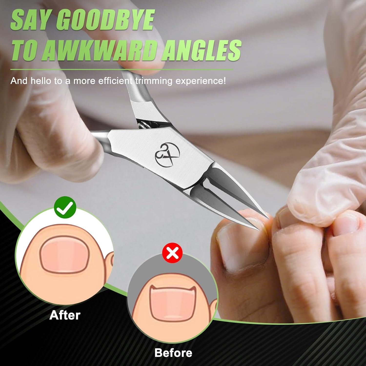 Cortador de Uñas Encarnadas HANDWENG Acero Inoxidable 12.5cm