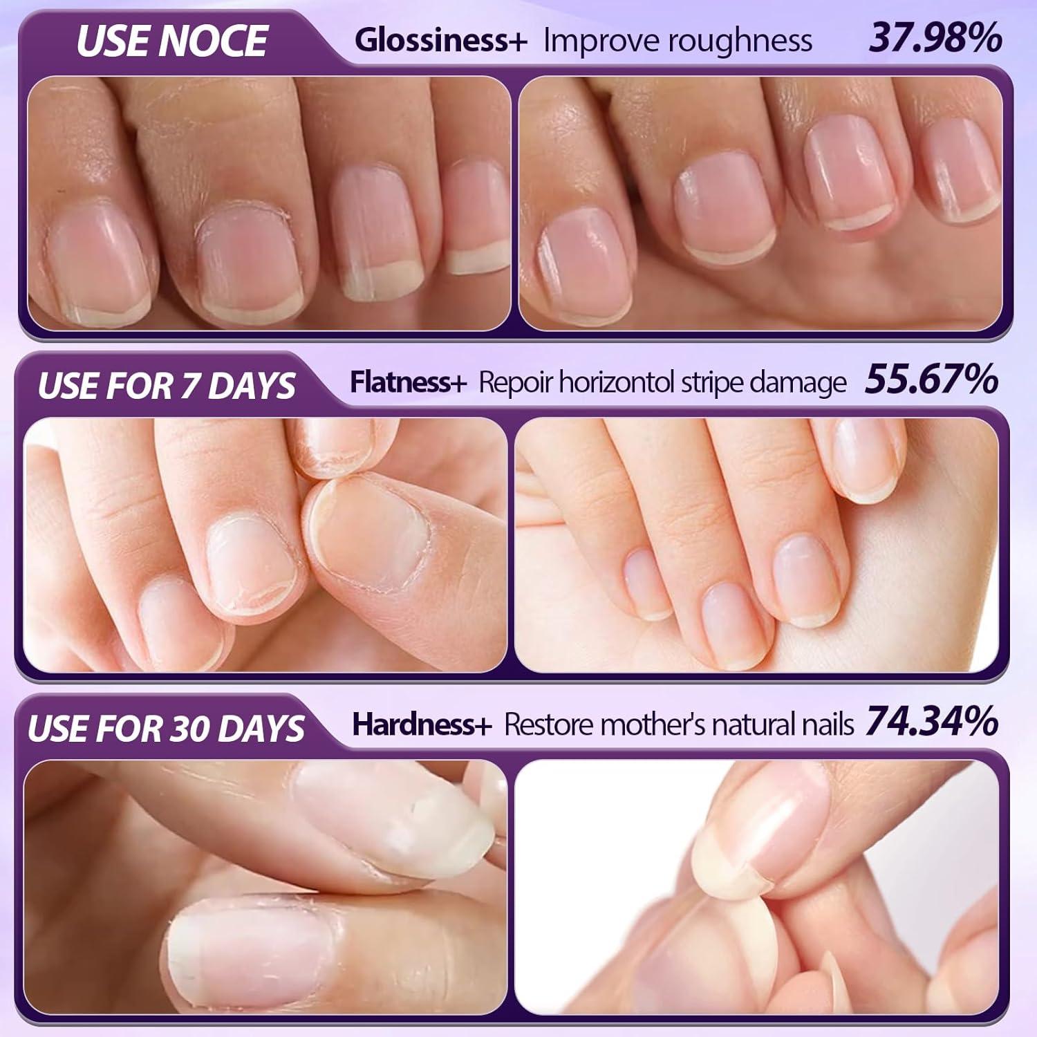 Bolígrafo de Cuidado de Uñas 3 en 1 VocdFing - Hidratante y Fortalecedor