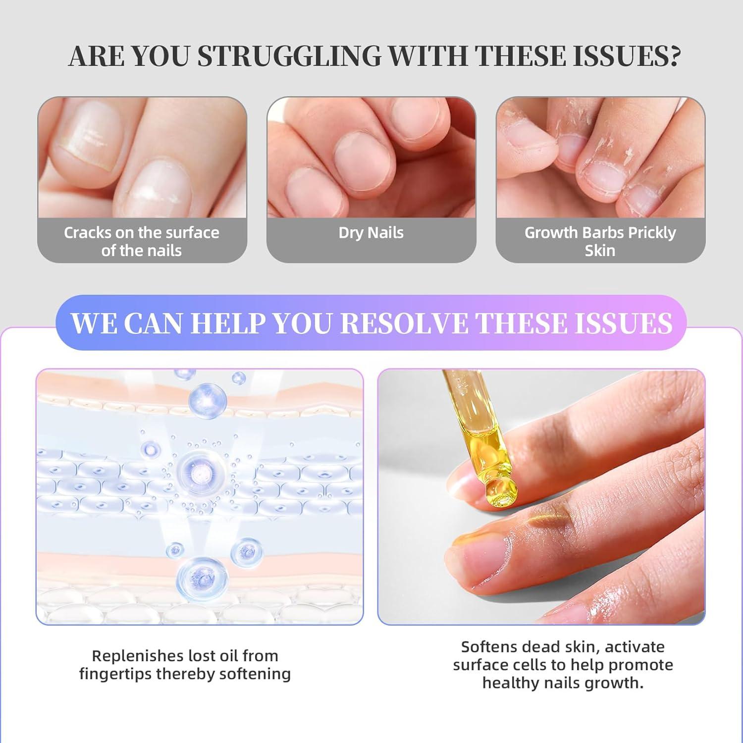 Kit de Manicura Profesional NORCICO: Removedor Gel 15ml + Aceite Cutículas 10ml