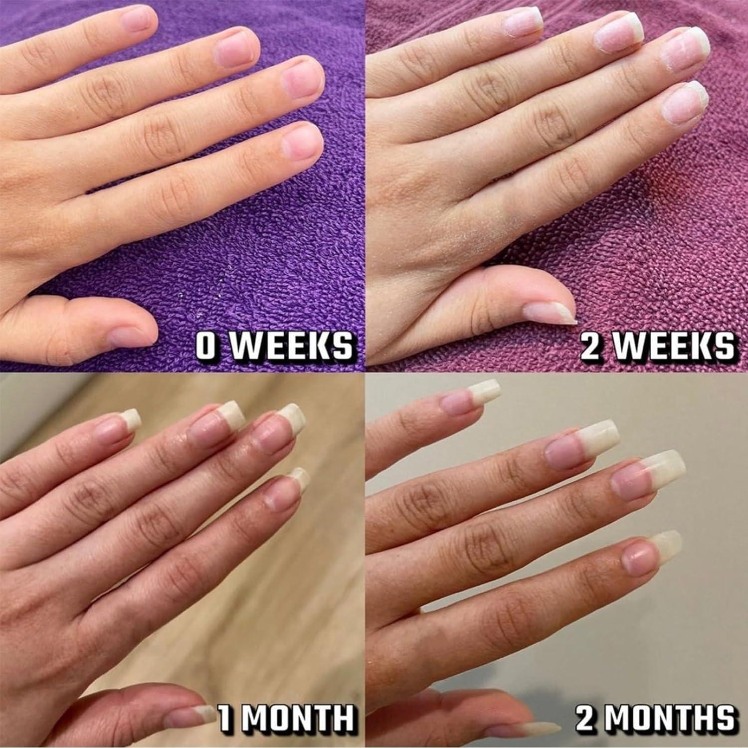 Aceite Endurecedor para Uñas Biaoyun - Crecimiento y Hidratación