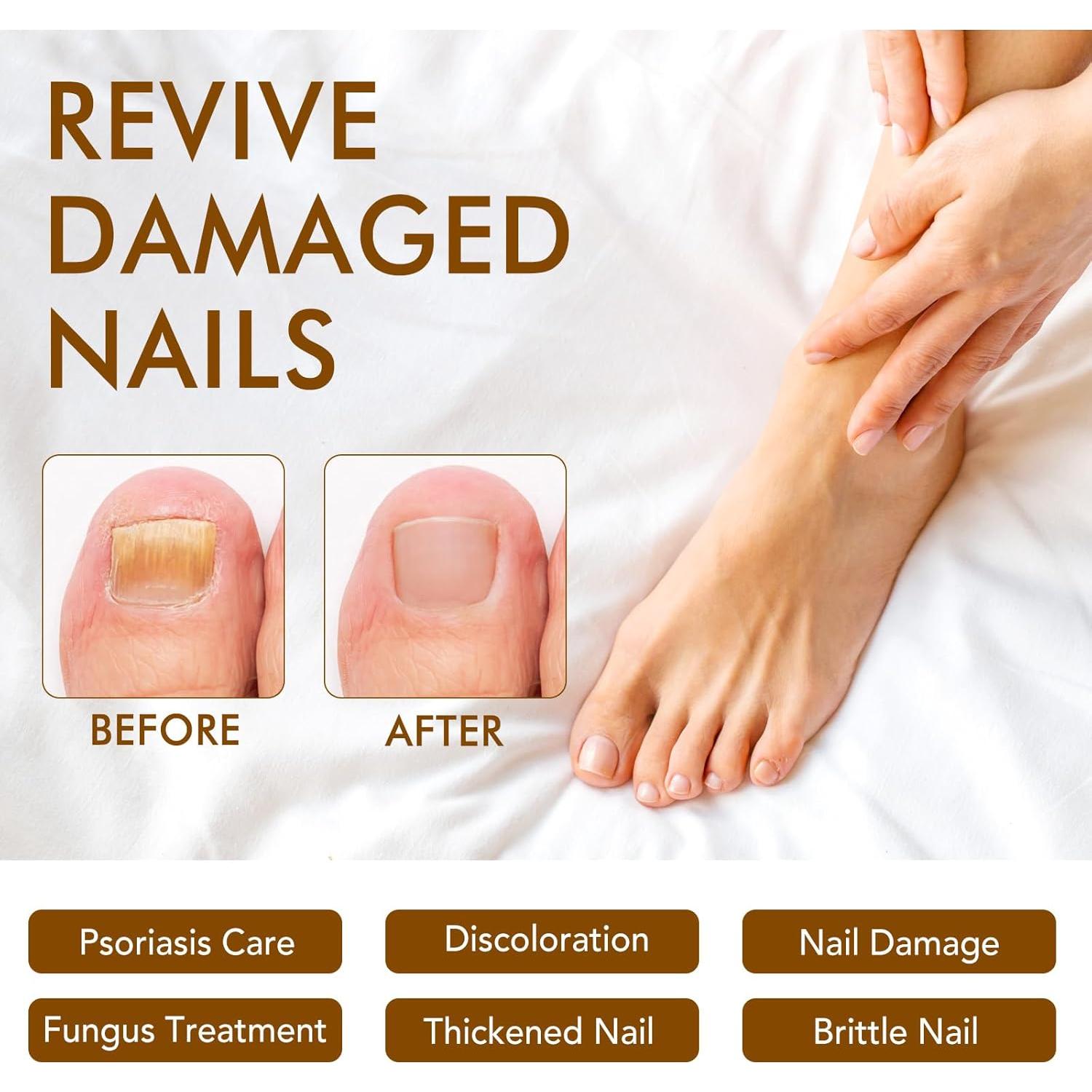 Suero de Jengibre para Uñas y Cutículas Leyosger 60ml