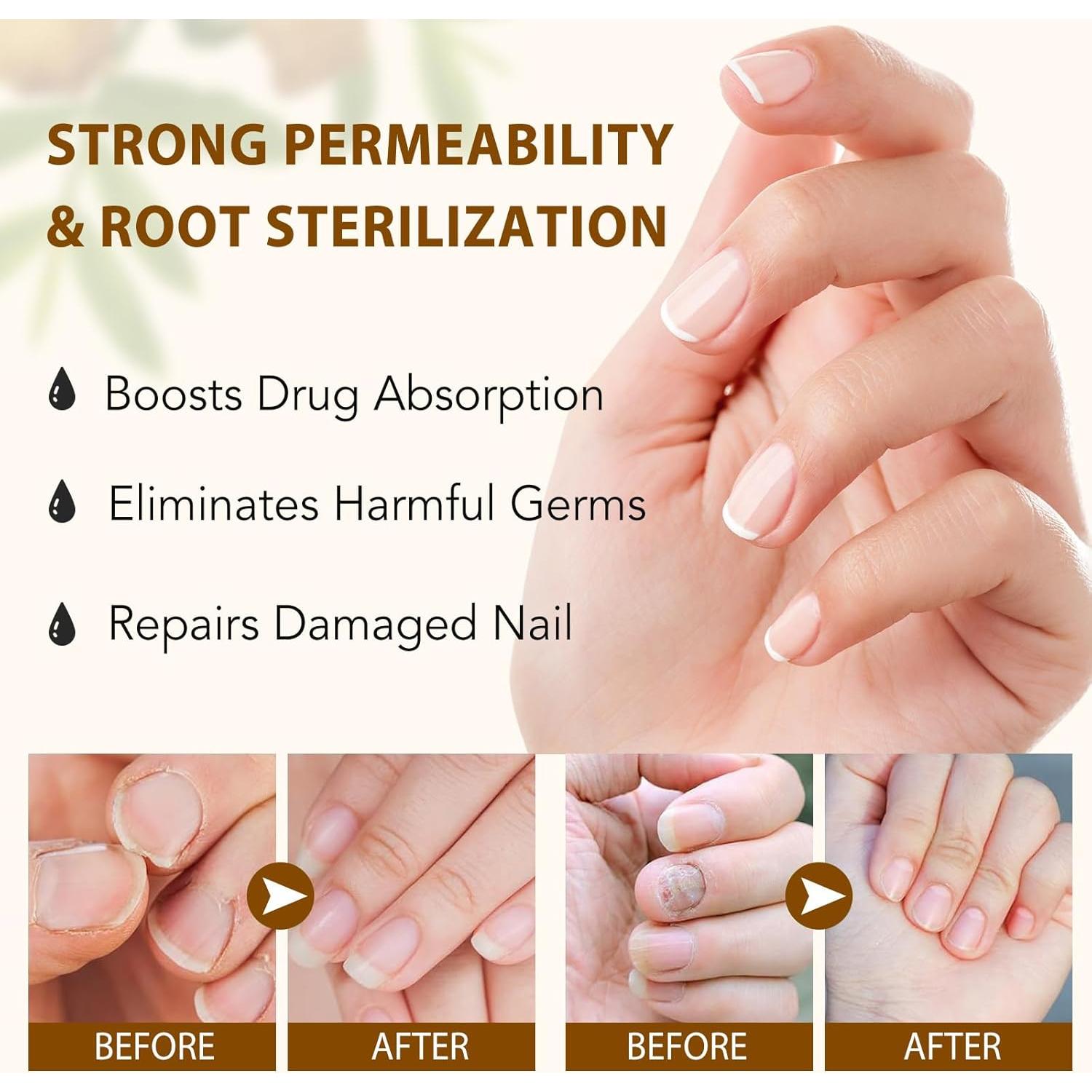 Suero de Jengibre para Uñas y Cutículas Leyosger 60ml