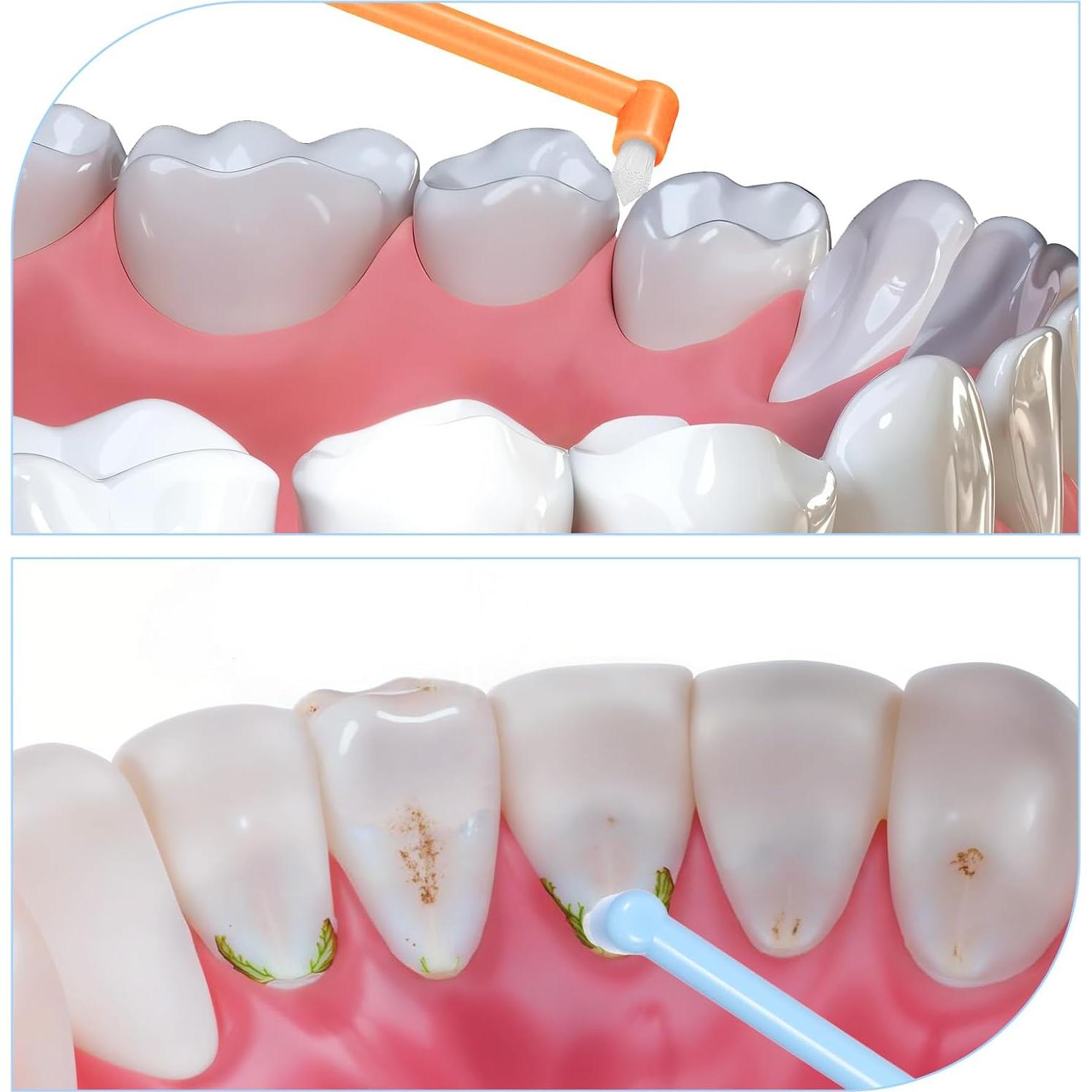 Set de 6 Cepillos de Dientes Suaves Bruislard para Limpieza Detallada