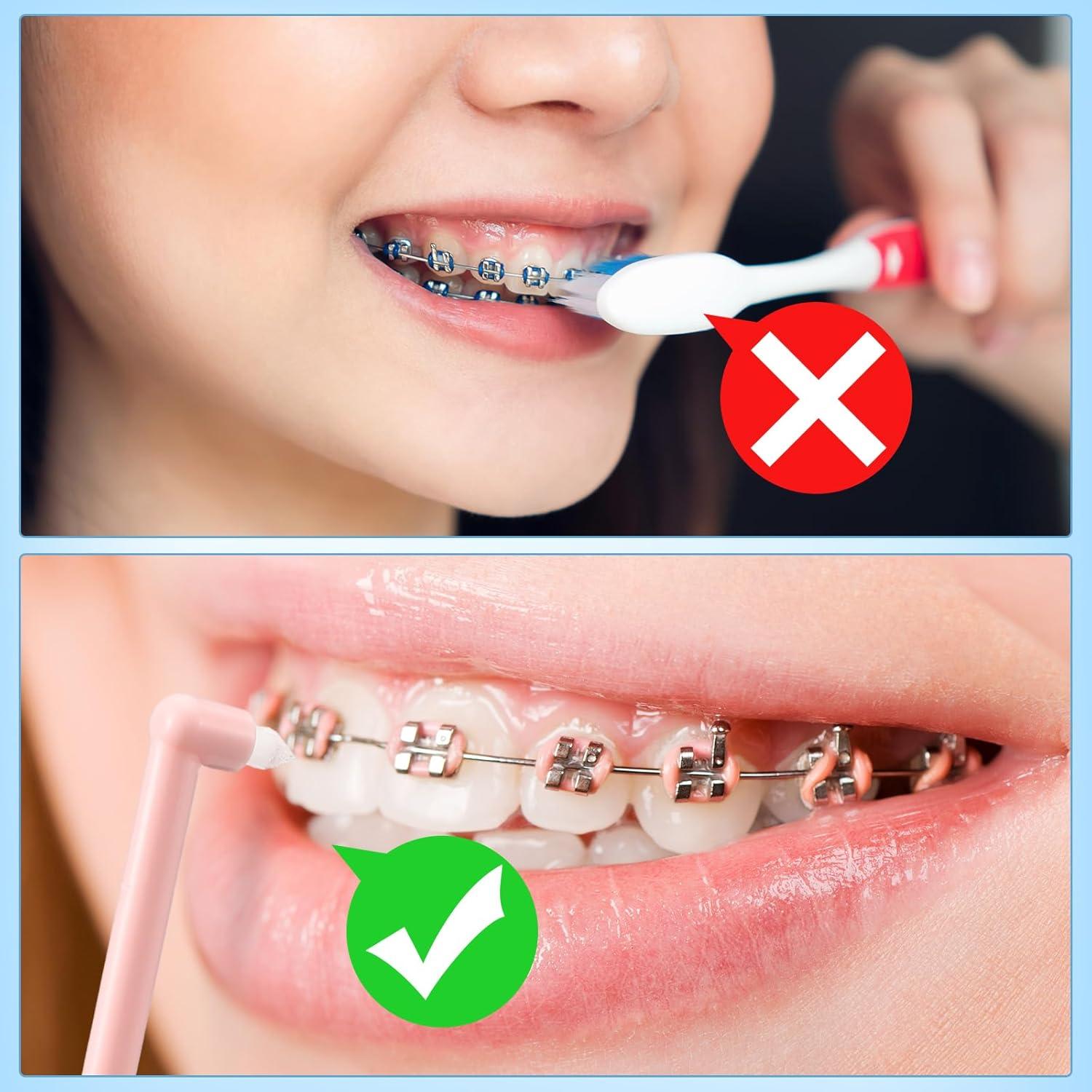 48 Cepillos de Dientes con Punta Final Qinyoung - Limpieza Detallada