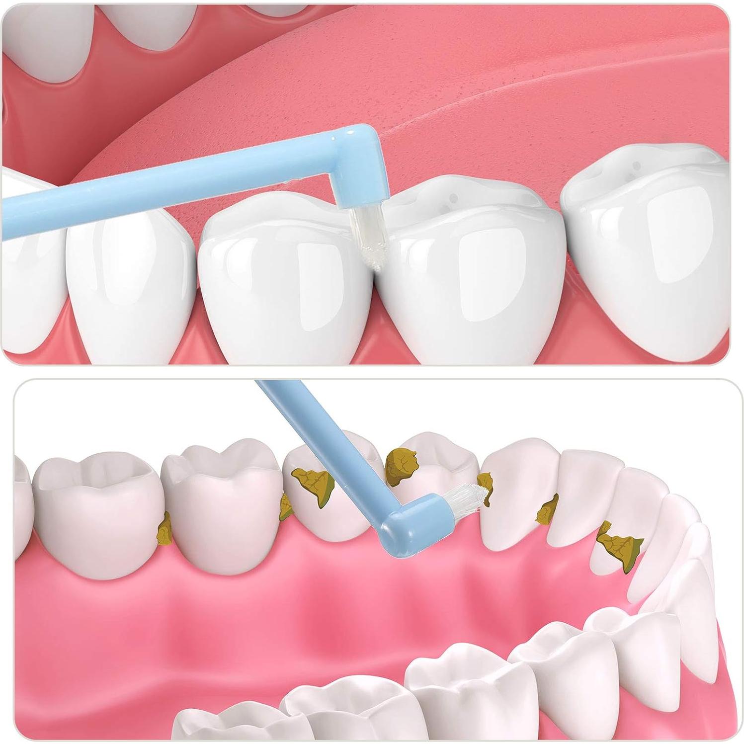 12 Cepillos Interdentales Suaves Patelai con Tapa Protectora