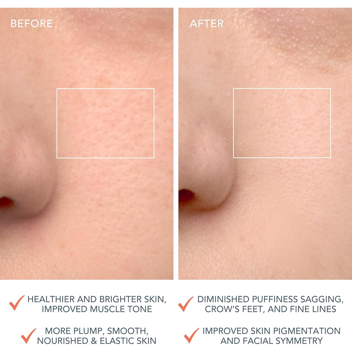 Cepillo Limpiador Facial Foreo LUNA 4 - Antienvejecimiento