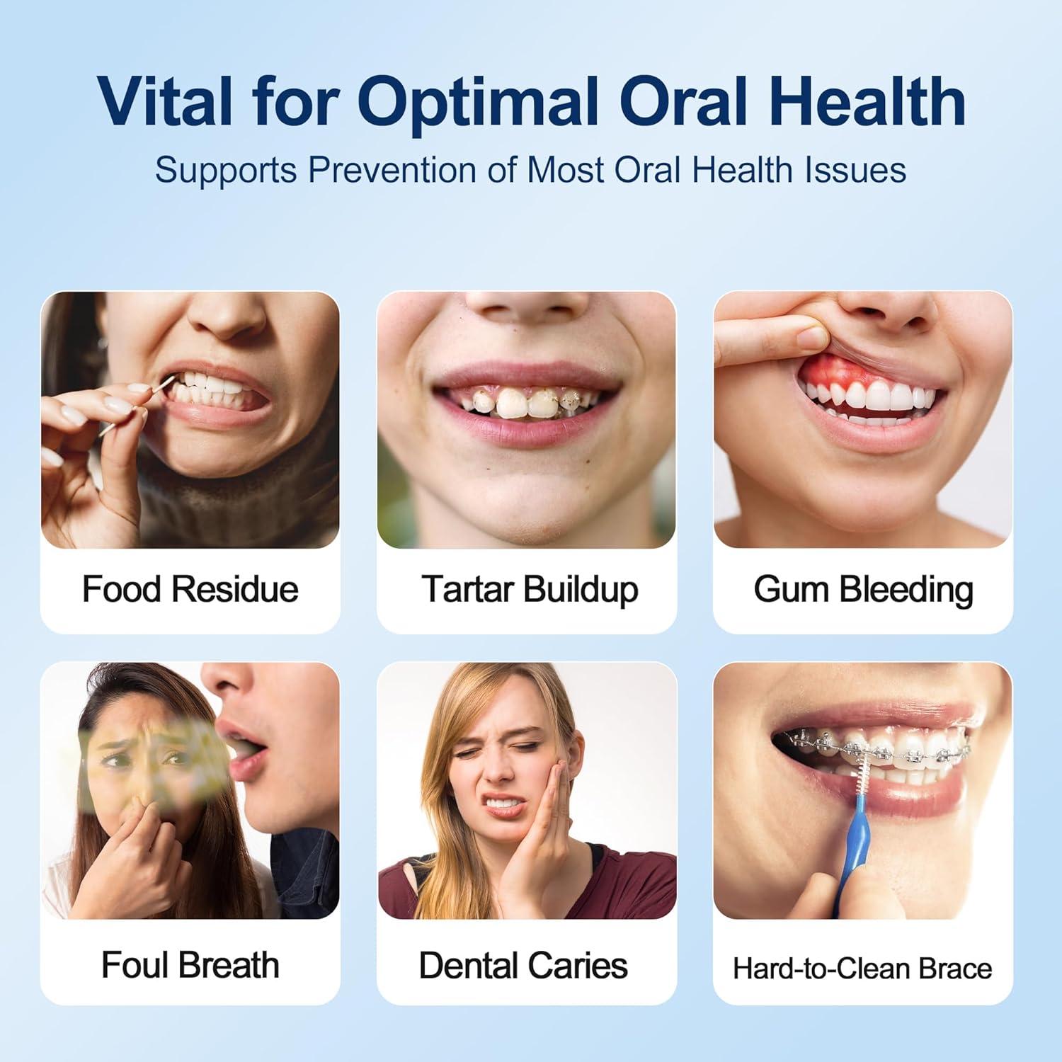 Irrigador Oral Inalámbrico MOCEL 300ML 5 Modos Pantalla LED