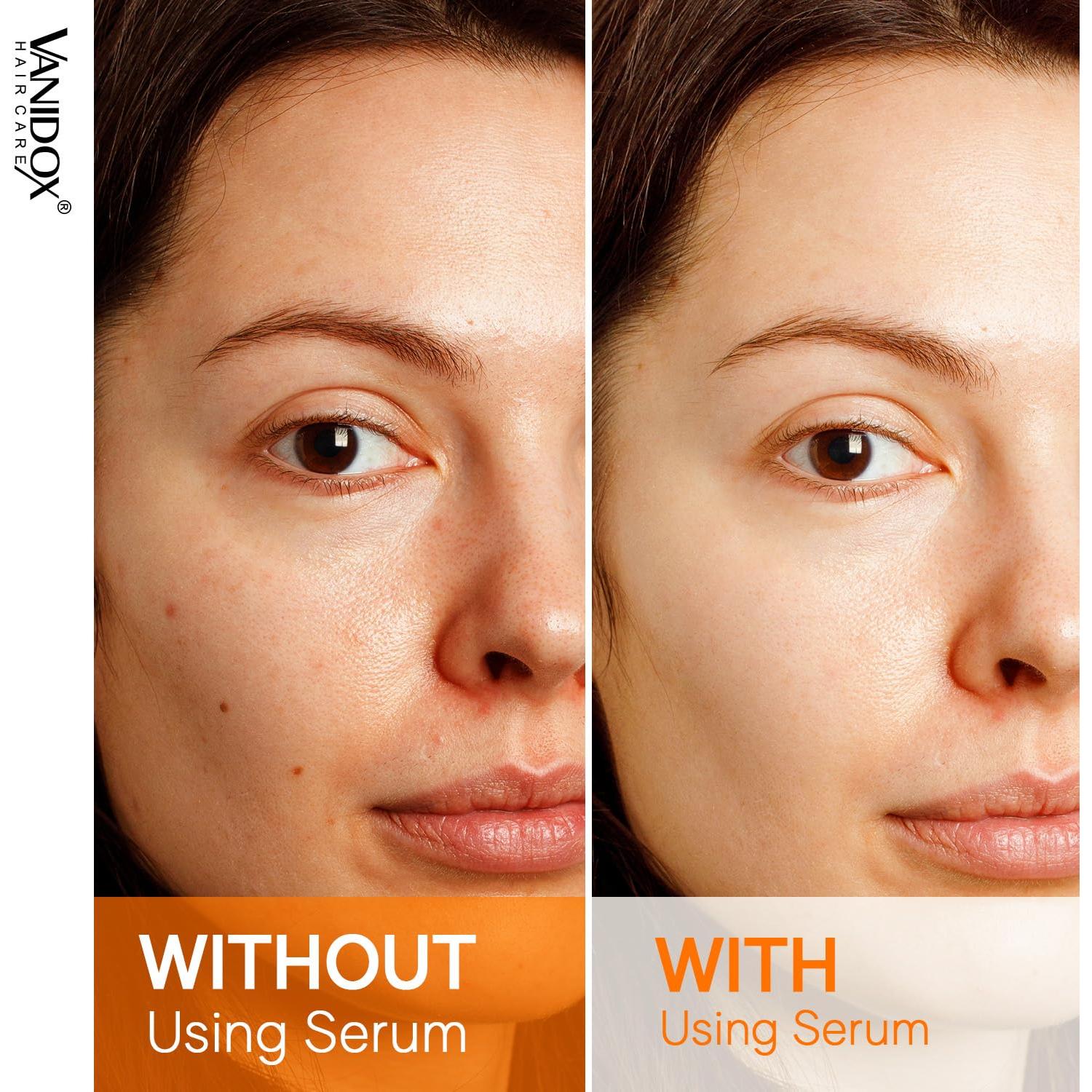 Sérum de Vitamina C Vanidox 29.57 ml - Hidratante y Reafirmante