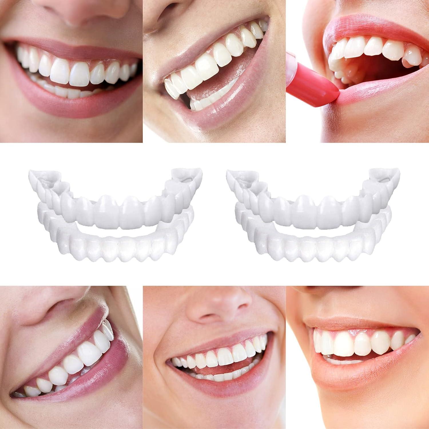 Carillas Dentales Ajustables YAFIYGI - 2 Pares Naturales