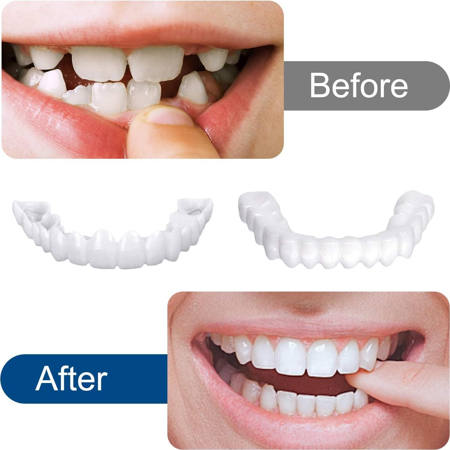 Carillas Dentales Ajustables YAFIYGI - 2 Pares Naturales