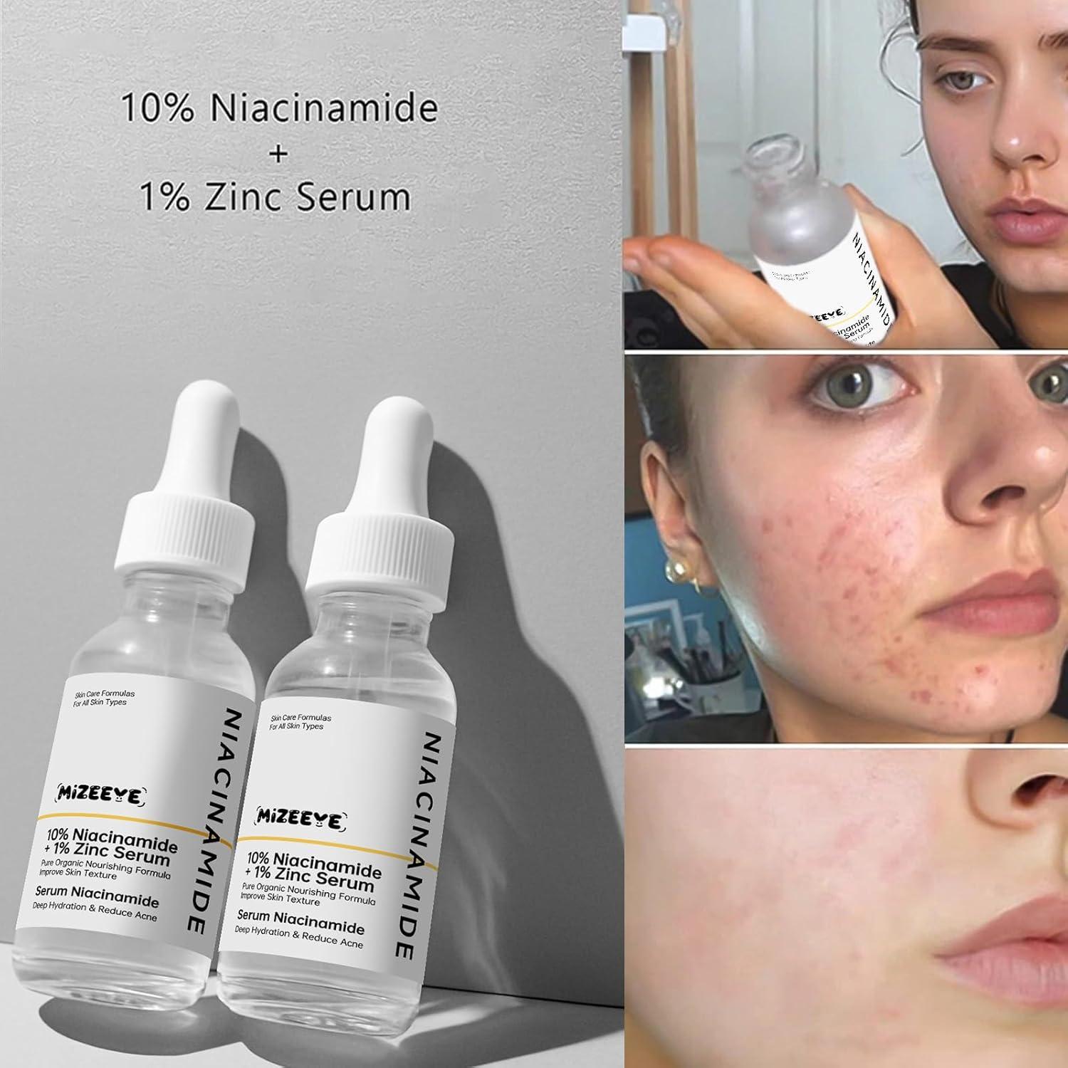 Suero Facial Niacinamida 10% + Zinc 1% MIZEEYE 80g