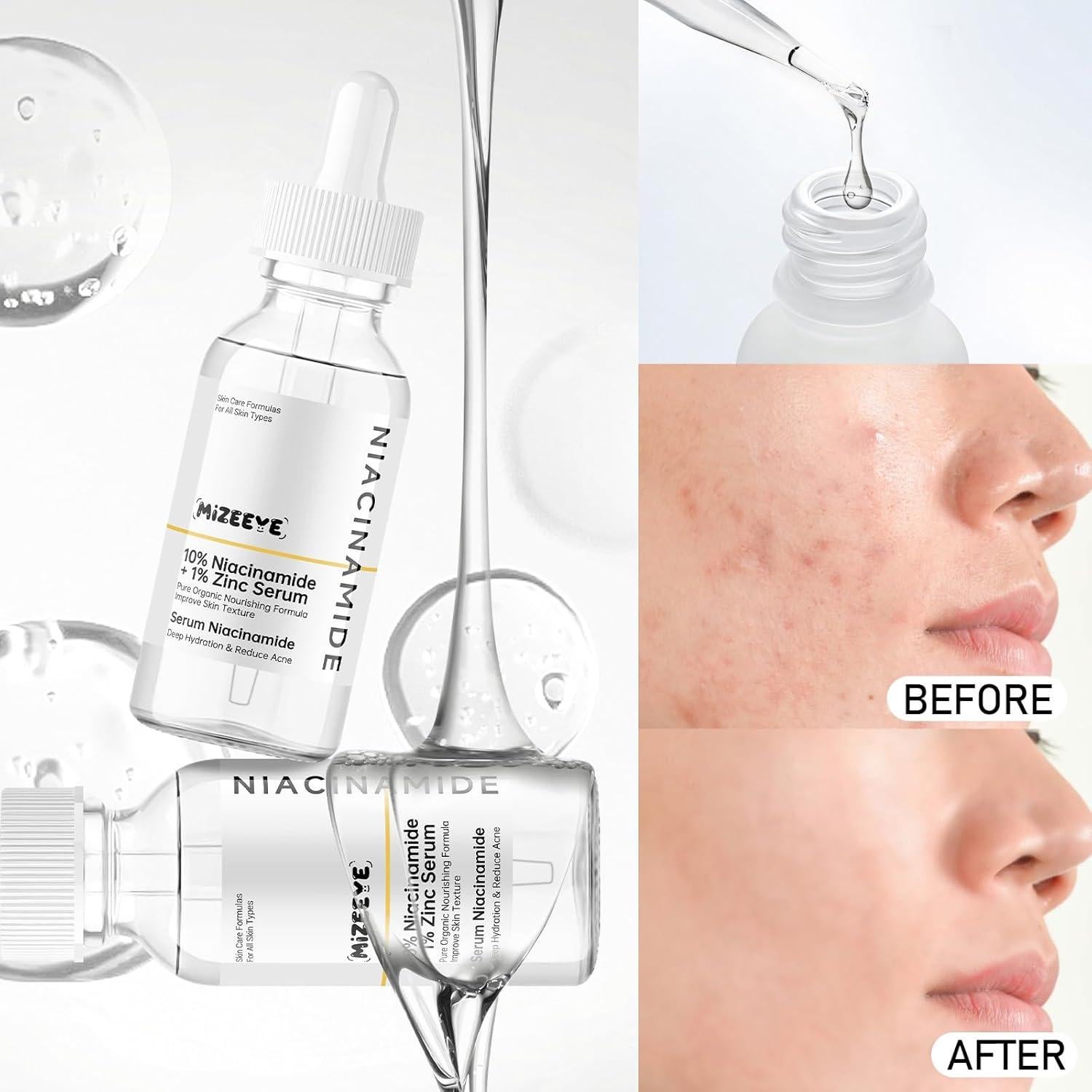 Suero Facial Niacinamida 10% + Zinc 1% MIZEEYE 80g