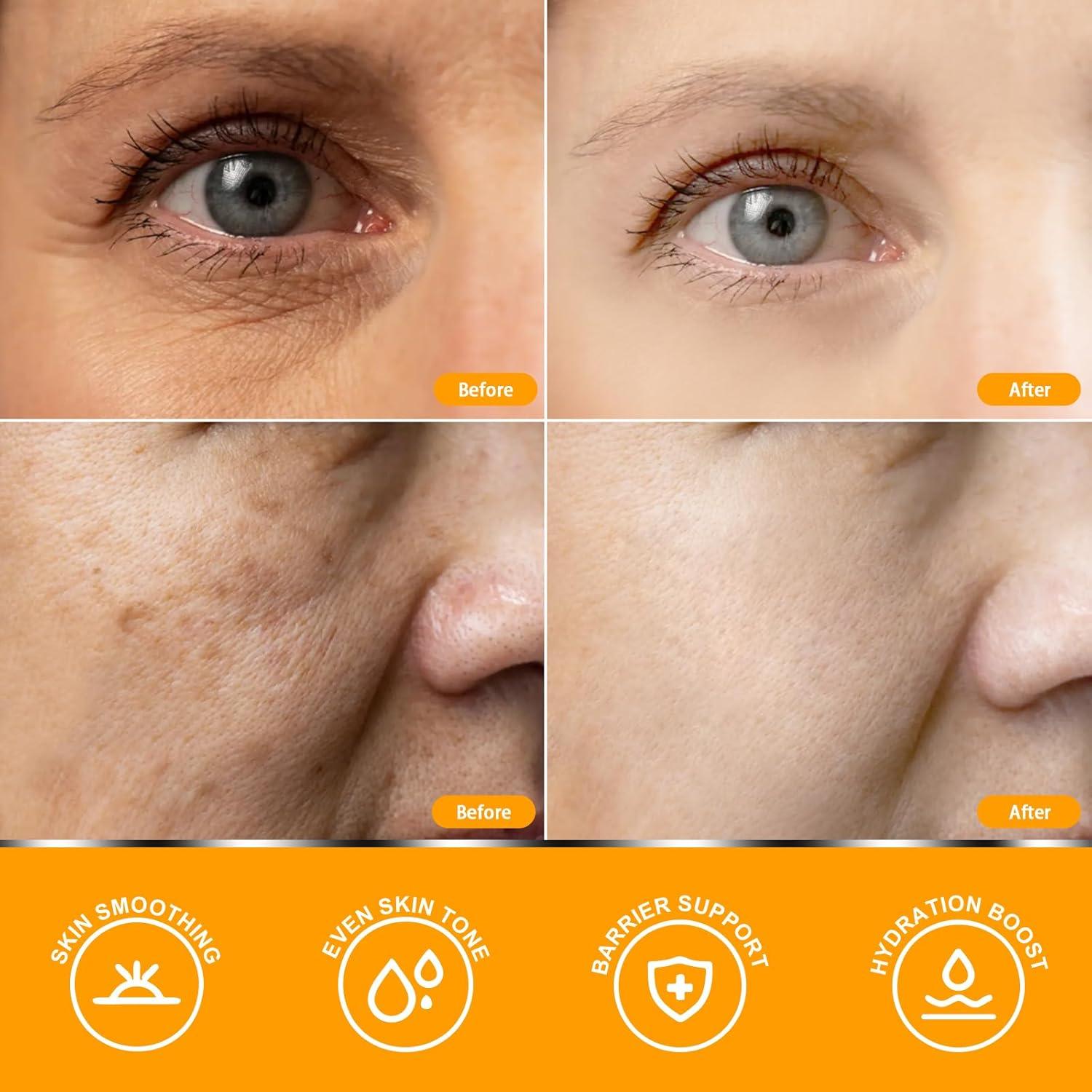 Suero de Vitamina C SkinRevive 49.9 ml para Piel Madura