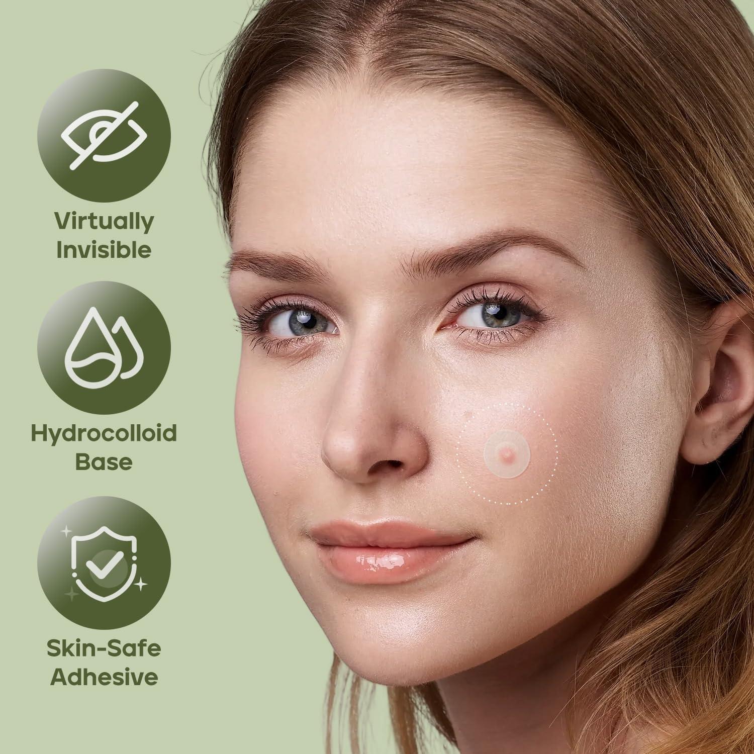 Parche para Acné Naterido Microdart 24 Unidades Ácido Hialurónico