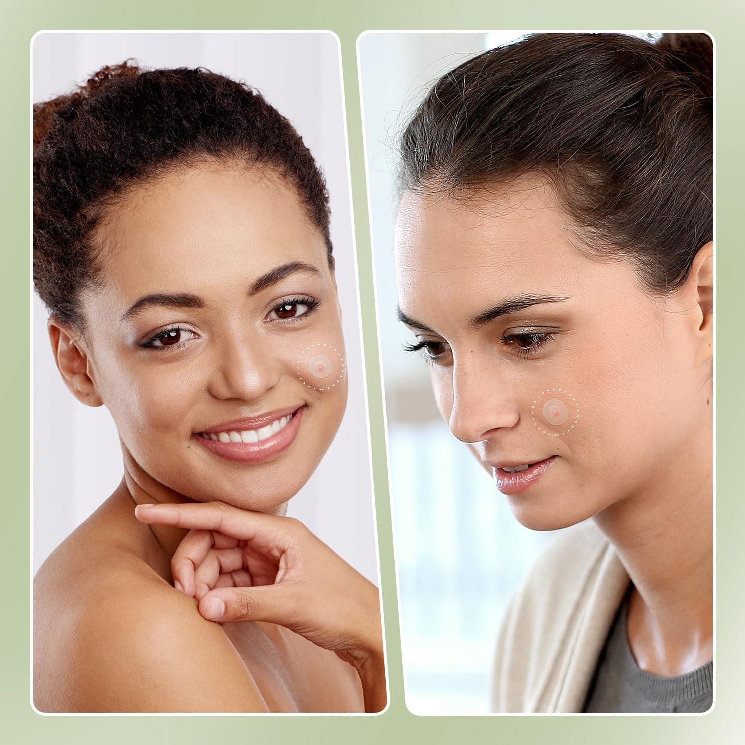 Parche para Acné Naterido Microdart 24 Unidades Ácido Hialurónico