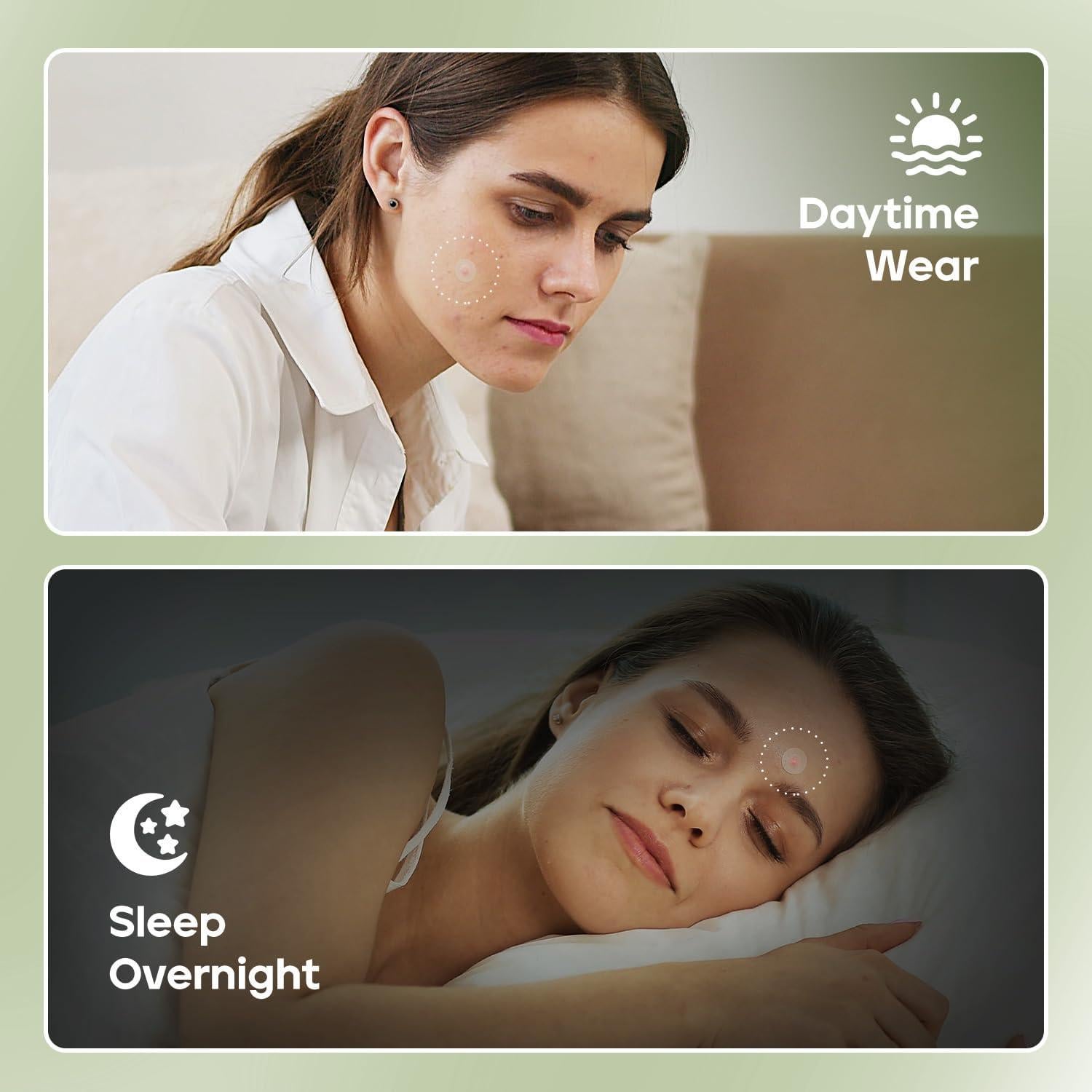 Parche para Acné Naterido Microdart 24 Unidades Ácido Hialurónico