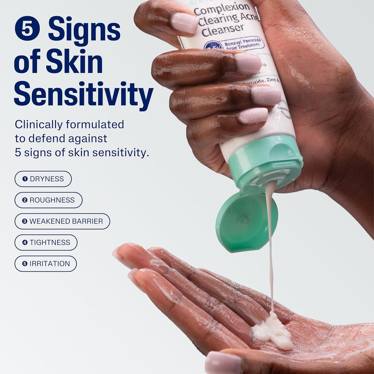 Limpiador de Acné Cetaphil Gentle Clear 119g - Suave para Piel Sensible