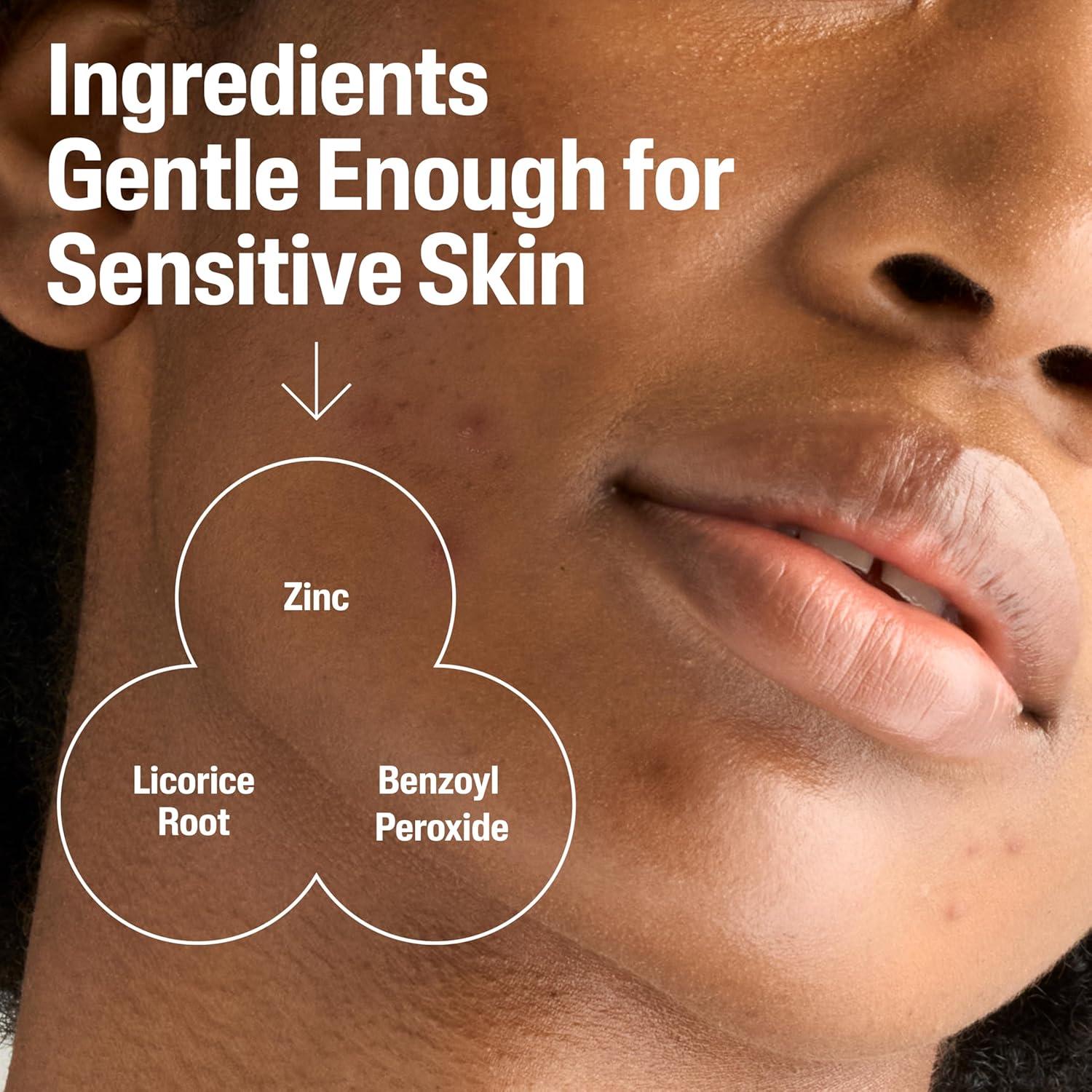 Limpiador de Acné Cetaphil Gentle Clear 119g - Suave para Piel Sensible