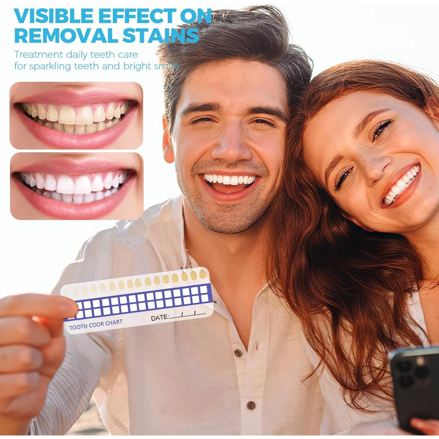 Kit Blanqueamiento Dental URSMILEKIT 16 LED Dientes Sensibles