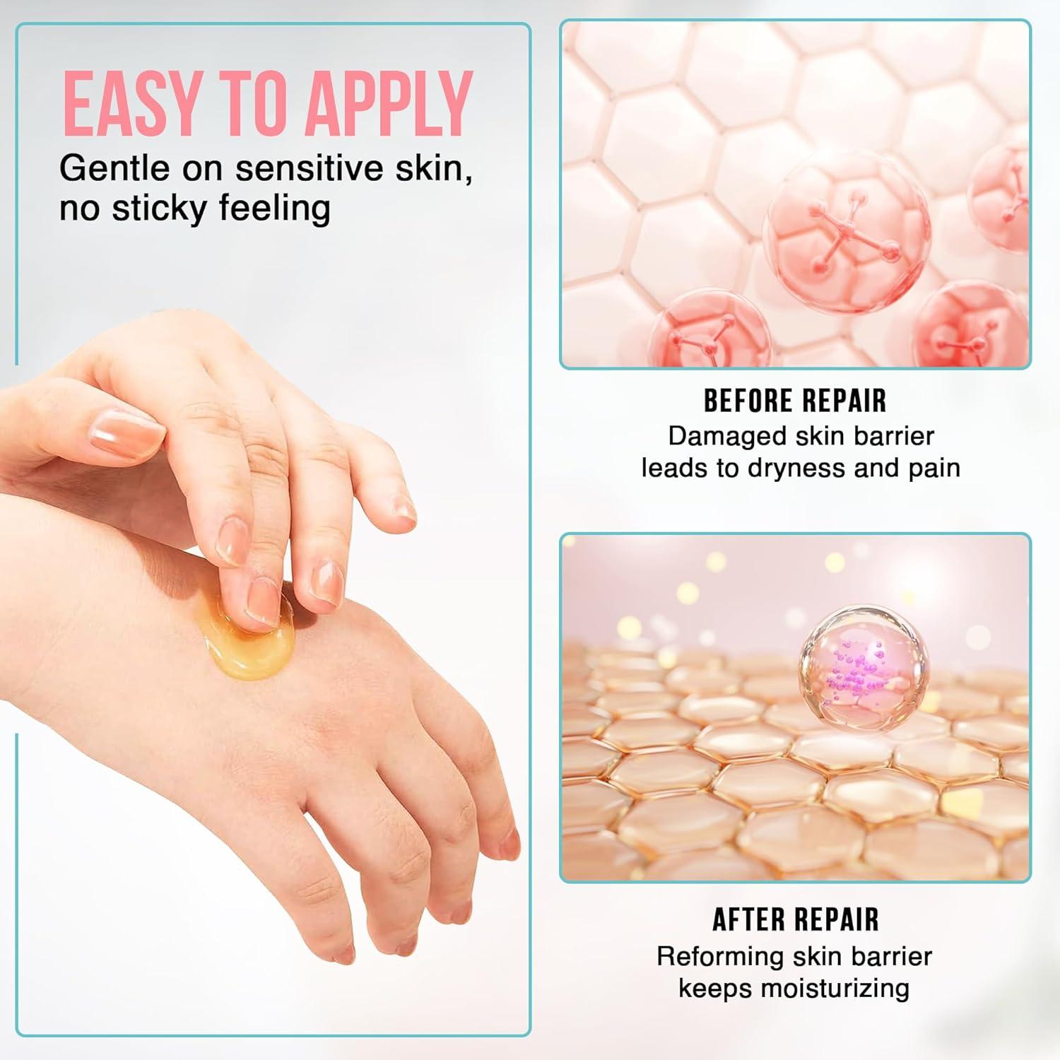 Crema de Lanolina Zomee para Pezones 40g - Alivio Lactancia