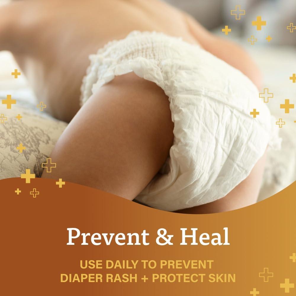 Ungüento A+D Original para Erupciones de Pañal 42g